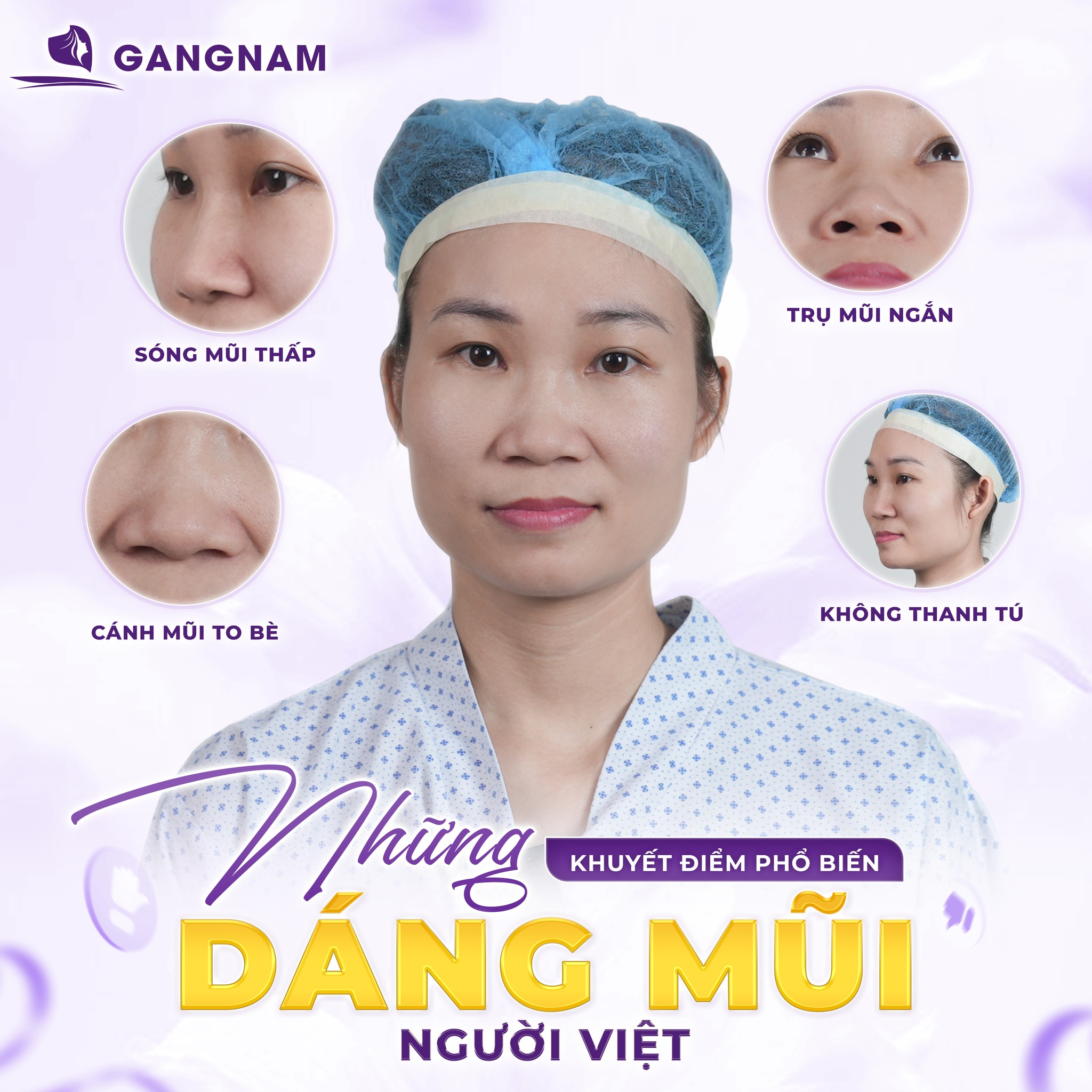 Nâng Mũi Sụn Sườn Cấu Trúc: Giải Pháp Tái Tạo Mũi Toàn Diện, Bền Vững 5 Đối tượng phù hợp với nâng mũi sụn sườn cấu trúc