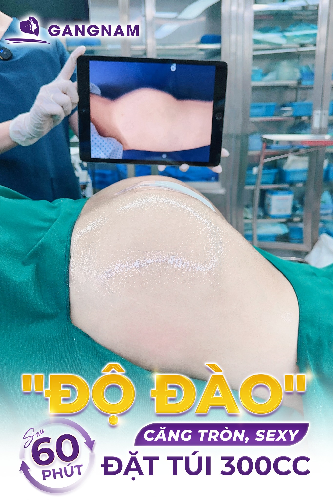 Nâng mông nội soi thẩm mỹ – Giải pháp hoàn hảo cho vòng 3 căng tròn tự nhiên 5 Túi độn mông trong nâng mông nội soi thẩm mỹ – Linh hồn quyết định chất lượng kết quả