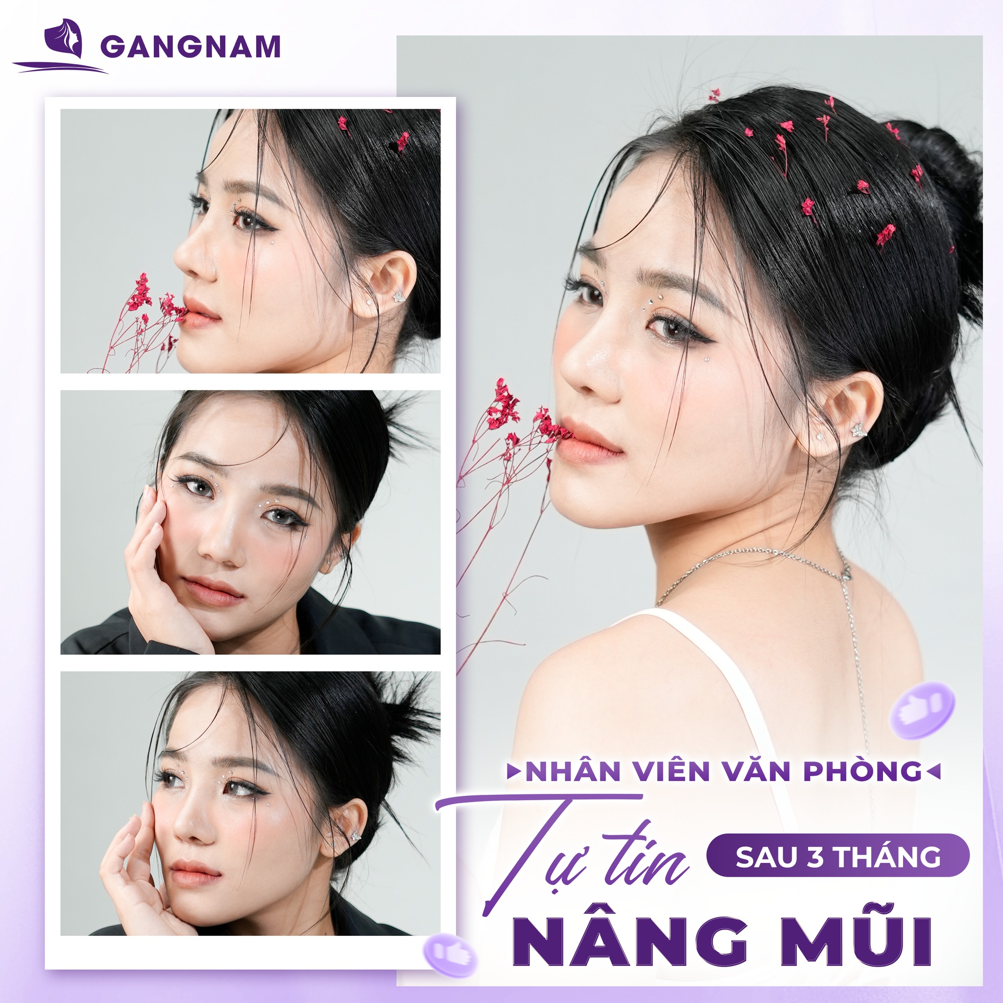 Nâng Mũi Sụn Sườn Cấu Trúc: Giải Pháp Tái Tạo Mũi Toàn Diện, Bền Vững 6 Nâng mũi sụn sườn cấu trúc tại Thẩm mỹ Gangnam