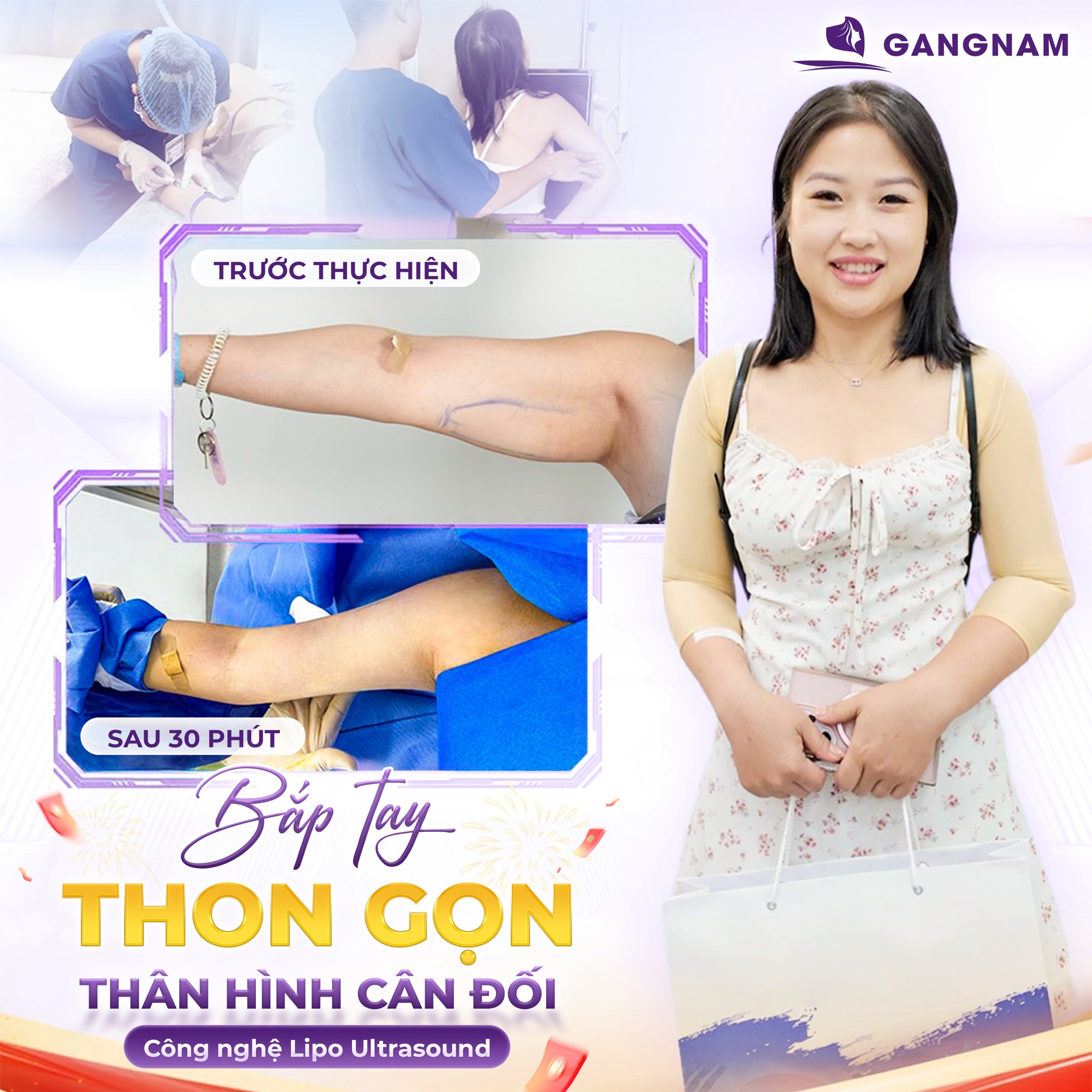 Giảm mỡ cánh tay Lipo Ultrasound: Giải pháp hiện đại cho đôi tay thon gọn 5 Quy trình thực hiện giảm mỡ cánh tay Lipo Ultrasound chi tiết