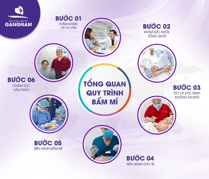 Bấm mí Dove Eyes an toàn – Giải pháp tạo mắt bồ câu tự nhiên, bền đẹp 5 Quy trình thực hiện bấm mí Dove Eyes an toàn chi tiết