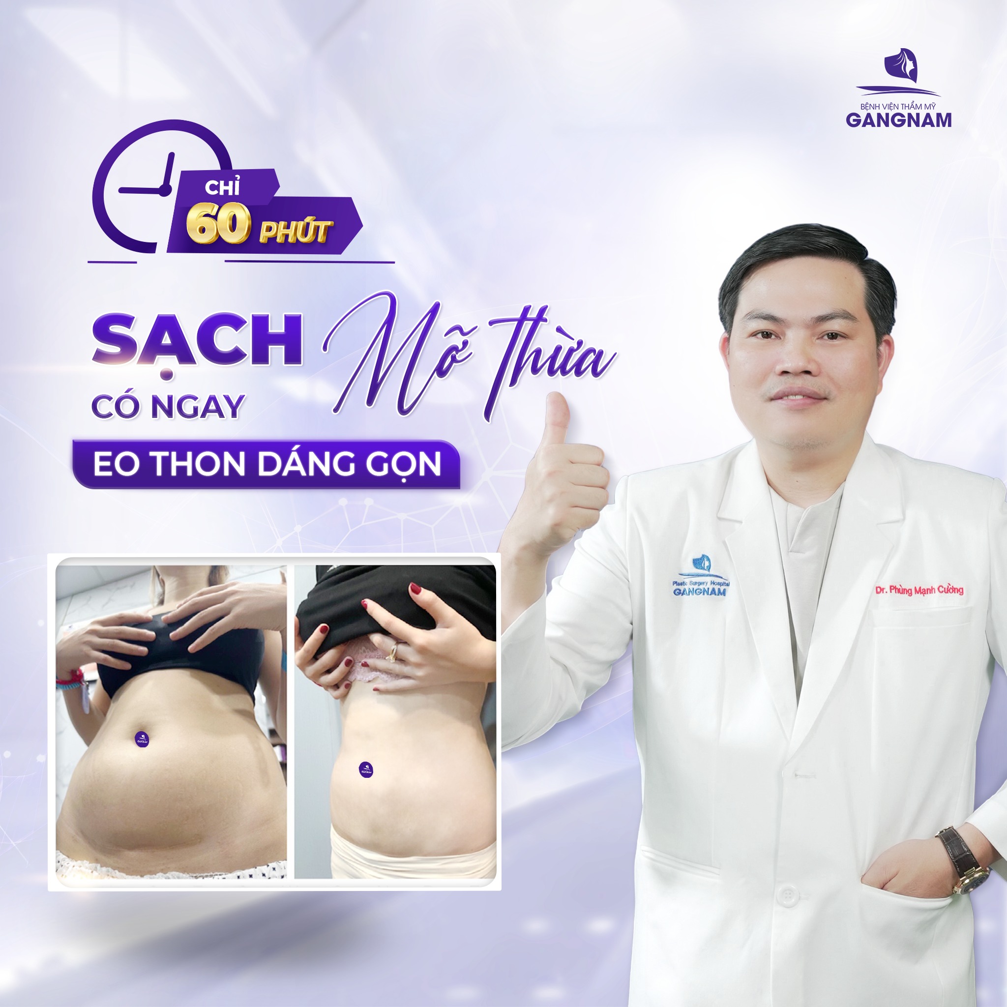 Hút mỡ hông – giải pháp loại bỏ mỡ thừa cứng đầu tạo vòng eo thon gọn 6 Hút mỡ hông tại Thẩm mỹ Gangnam – Giải pháp tạo đường cong chuẩn đẹp