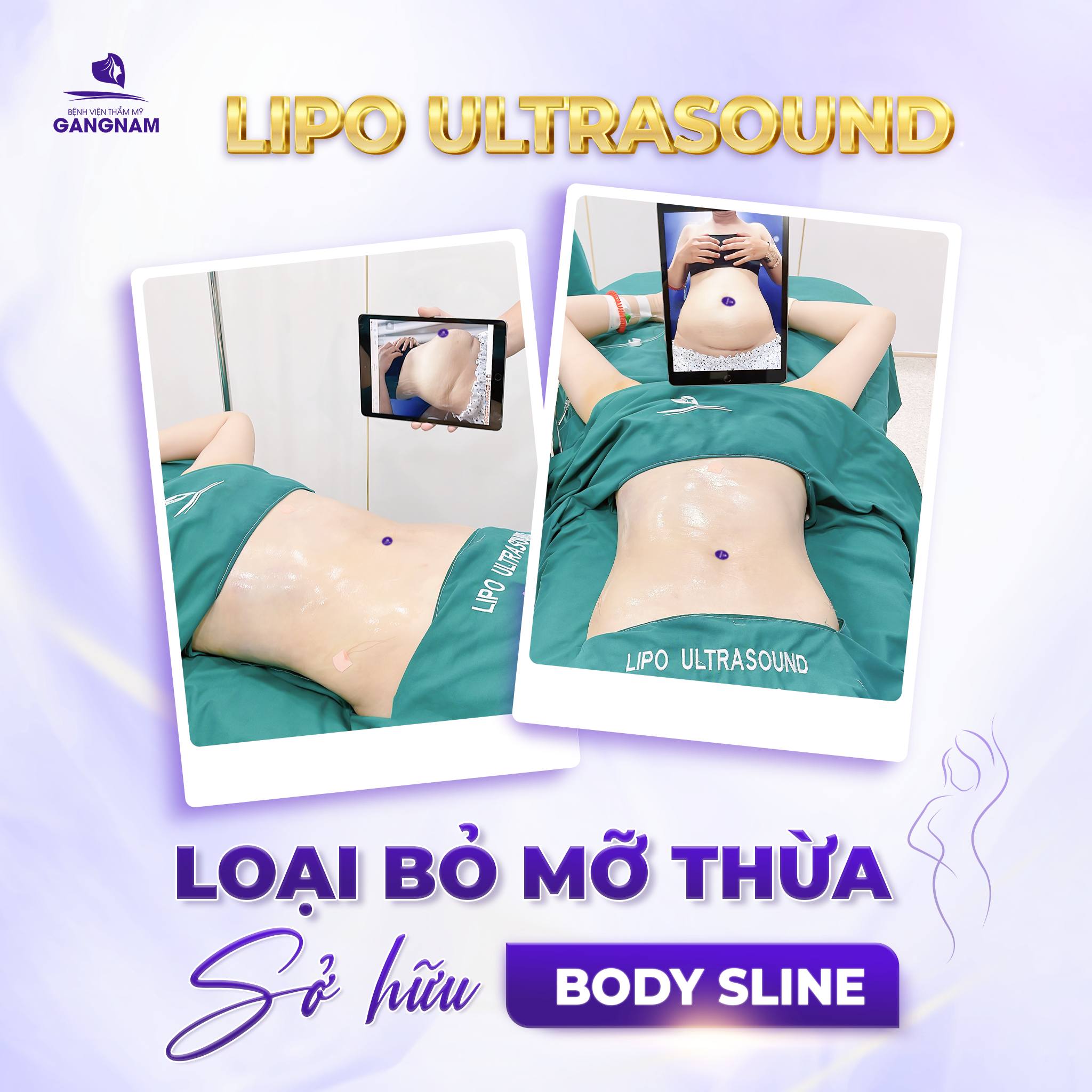 Giảm mỡ eo Lipo – Giải pháp công nghệ cao lấy lại vòng eo thon gọn 4 Giảm mỡ eo Lipo là gì và cơ chế hoạt động