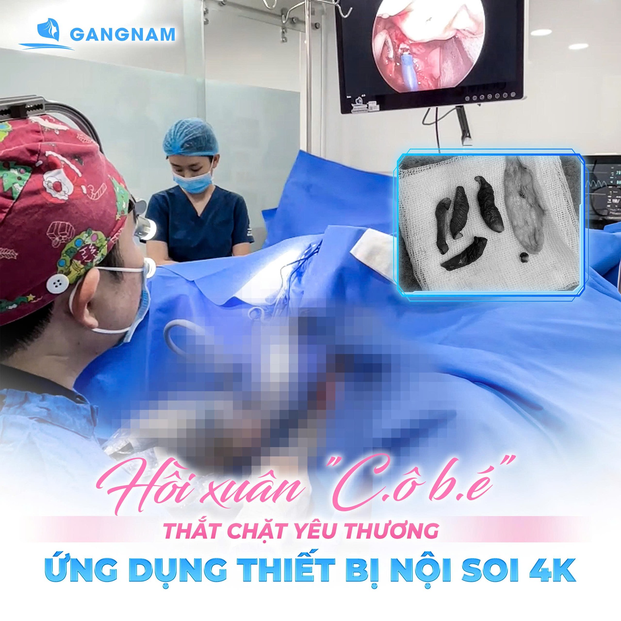 Thẩm mỹ làm hồng cô bé – Giải pháp lấy lại sự tự tin và tươi trẻ cho vùng kín 6 Tại sao vùng kín bị thâm sạm và cần thẩm mỹ làm hồng cô bé?