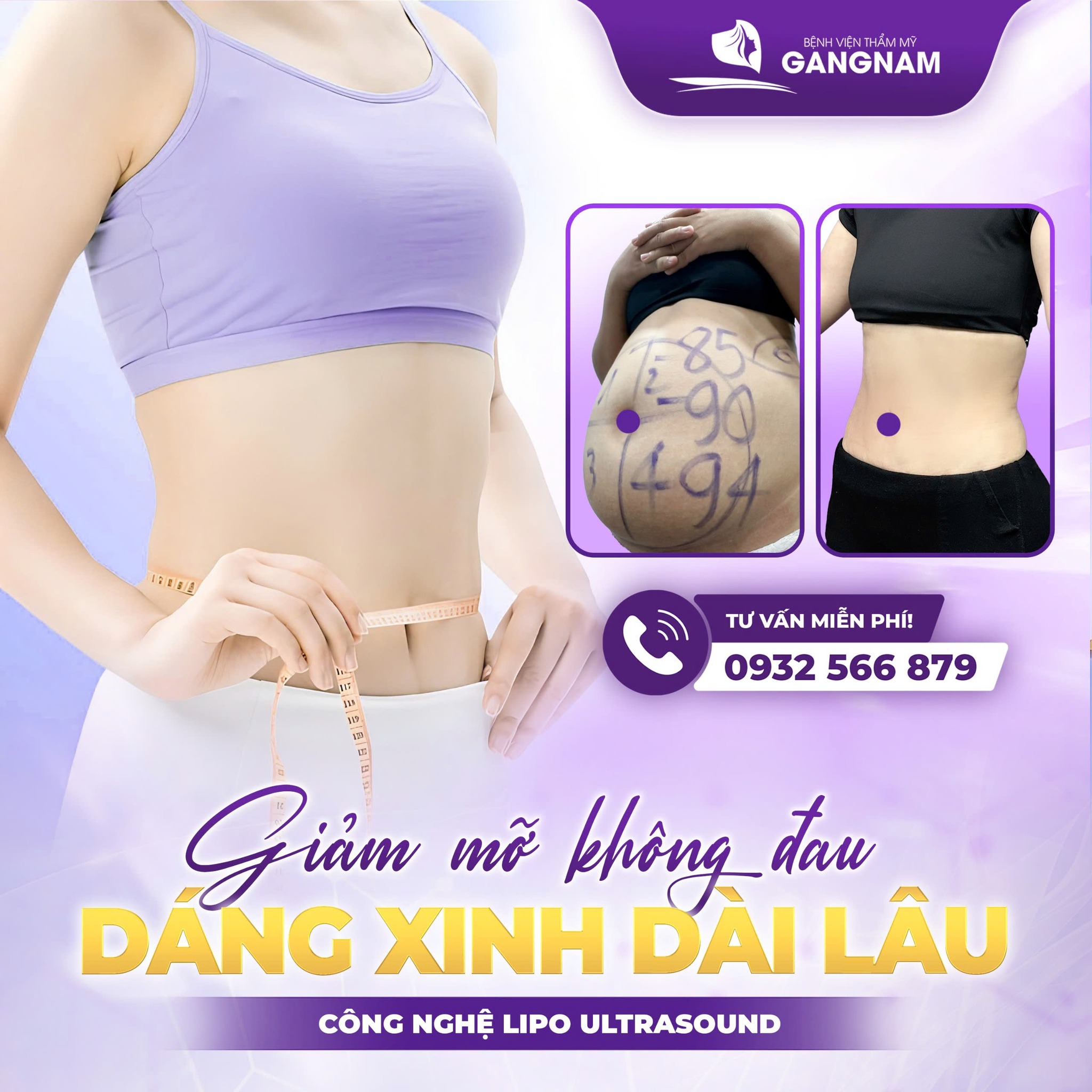 Hút mỡ vòng eo Lipo – Giải pháp lấy lại vòng eo thon gọn nhanh chóng 6 Thẩm mỹ Gangnam – Địa chỉ thực hiện Hút mỡ vòng eo Lipo an toàn, chuẩn y khoa