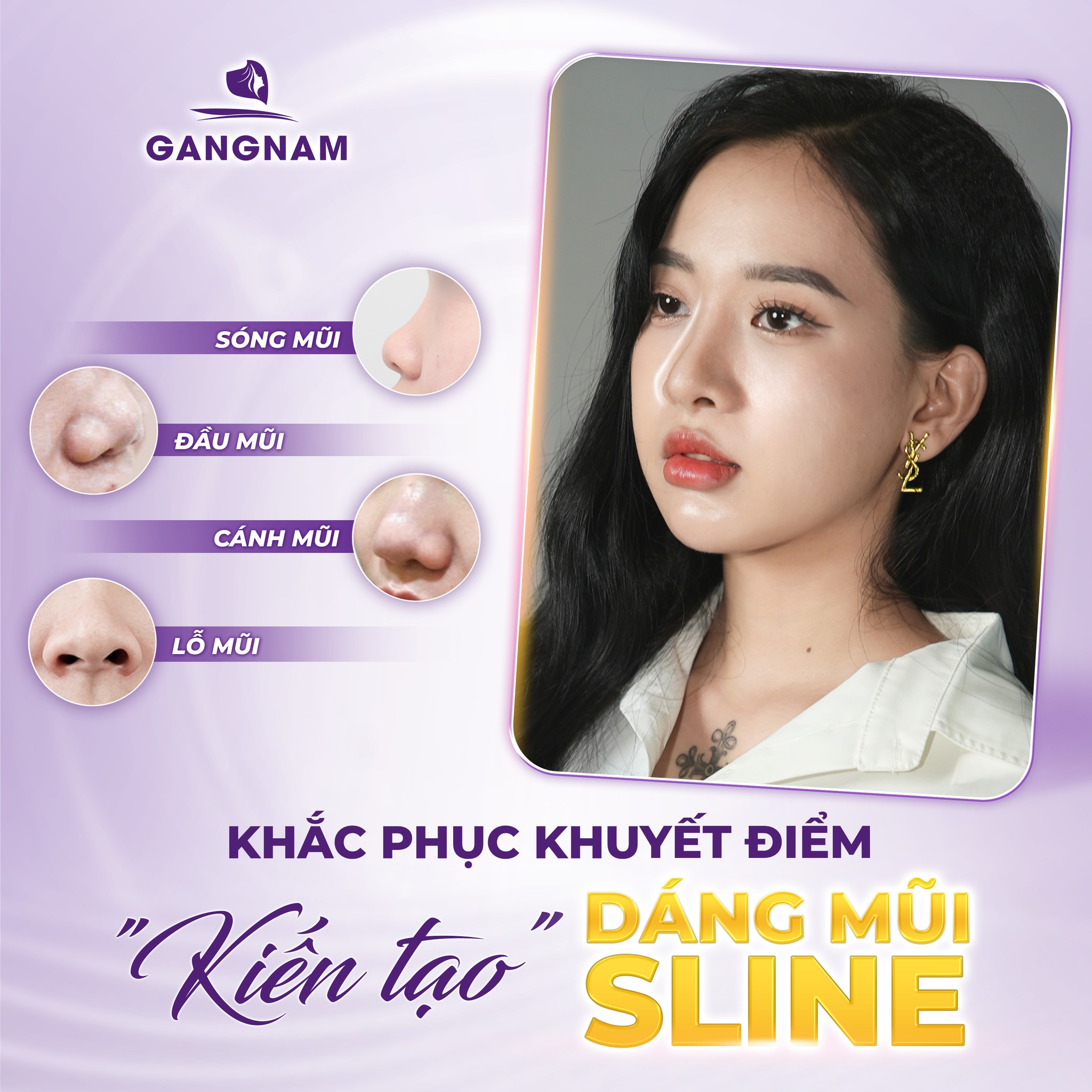 Nâng mũi Sline thẩm mỹ: Bí quyết sở hữu dáng mũi thanh thoát chuẩn tỷ lệ vàng 6 Nâng mũi Sline thẩm mỹ chuẩn đẹp tự nhiên tại Thẩm mỹ Gangnam