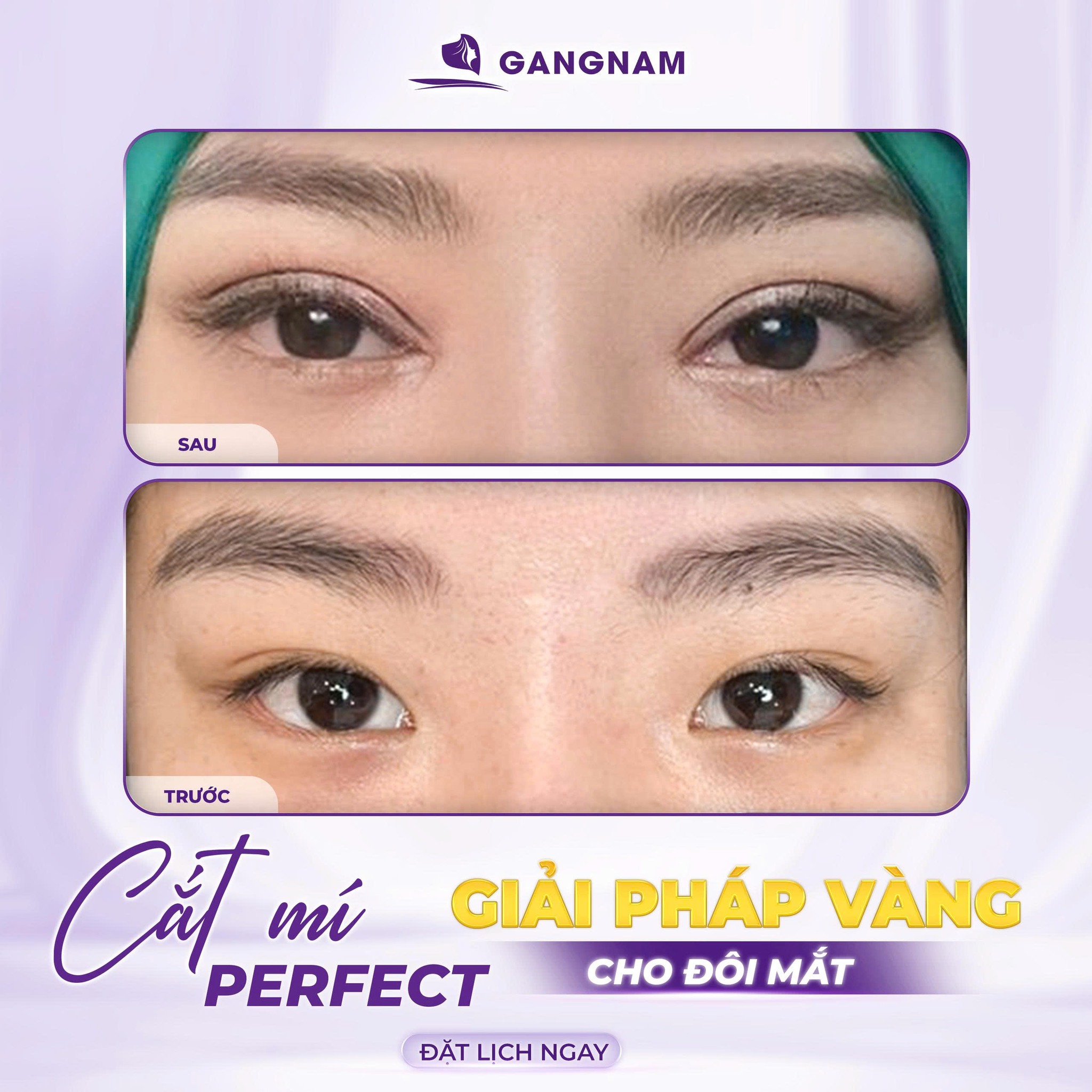 Bấm Mí Perfect – Giải Pháp Tạo Mí Đa Điểm Hiện Đại Cho Đôi Mắt Tự Nhiên 4 Tại sao Bấm mí Perfect được gọi là "hoàn hảo"?