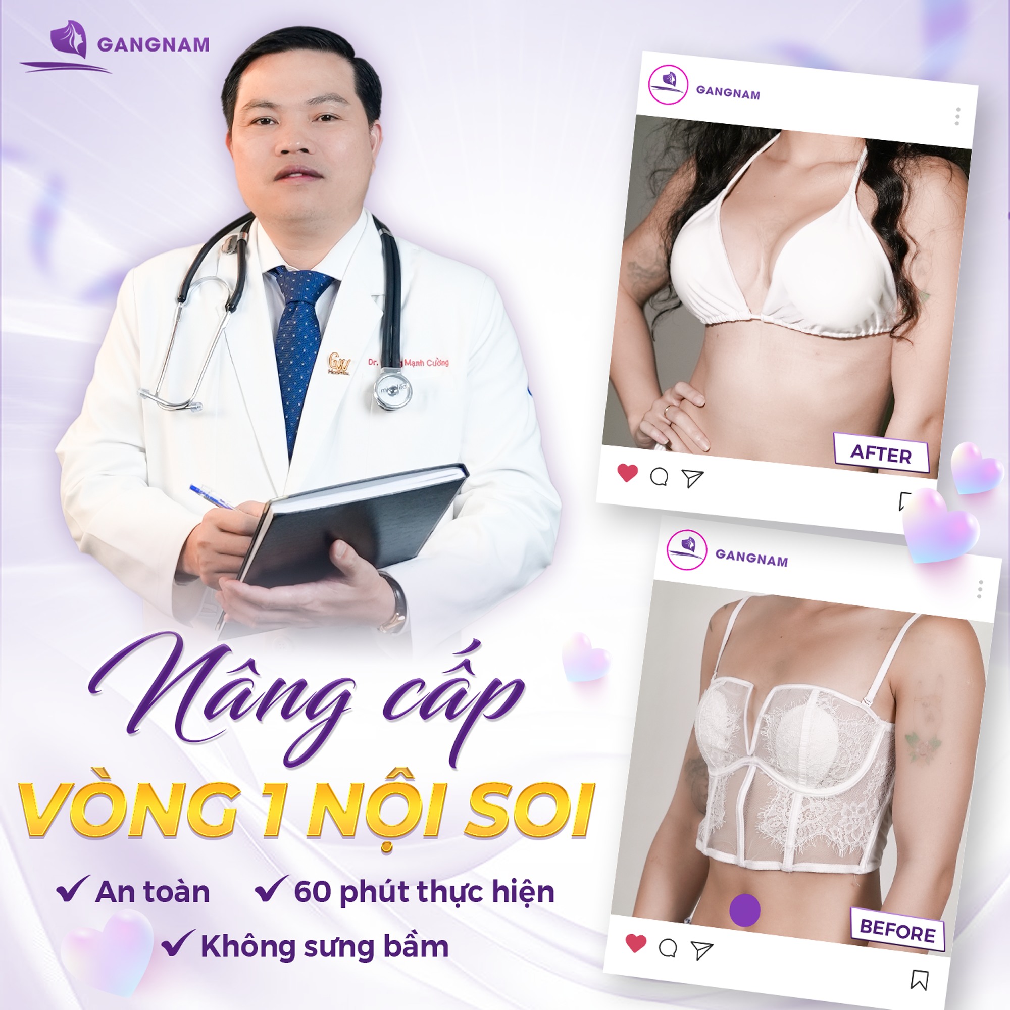 Thẩm mỹ nâng ngực nội soi 4K: Công nghệ hiện đại cho vòng một hoàn hảo 6 Nâng ngực nội soi 4K tại Thẩm mỹ Gangnam