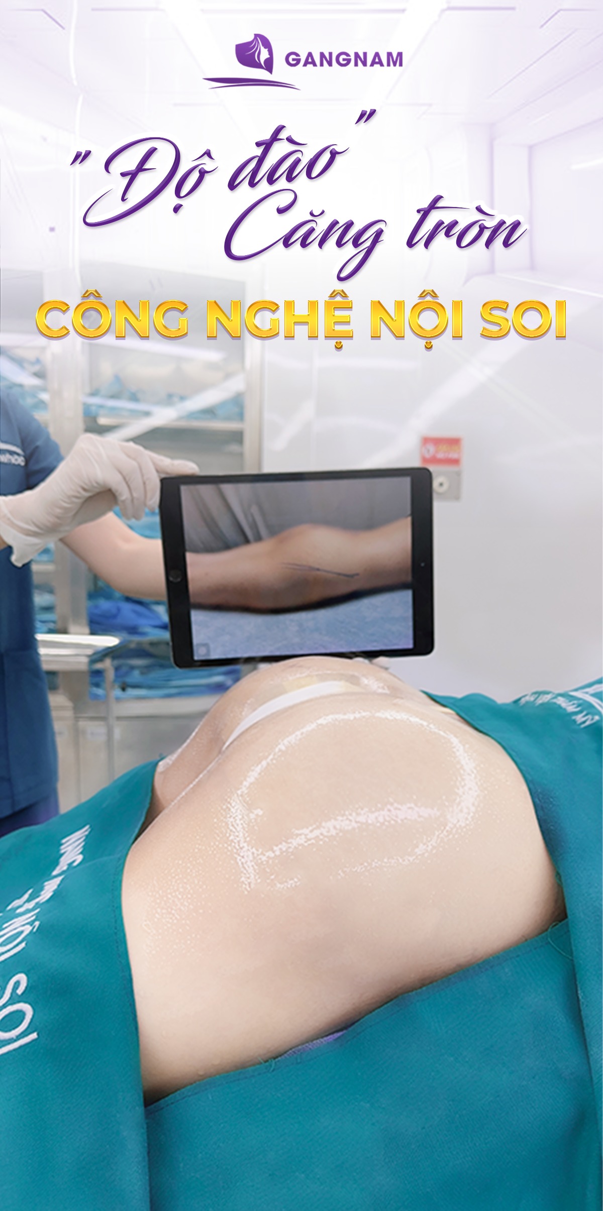 Nâng vòng 3 dáng chuẩn – bí quyết sở hữu mông căng tròn, săn chắc 5 Nâng vòng 3 dáng chuẩn có an toàn và phù hợp với ai