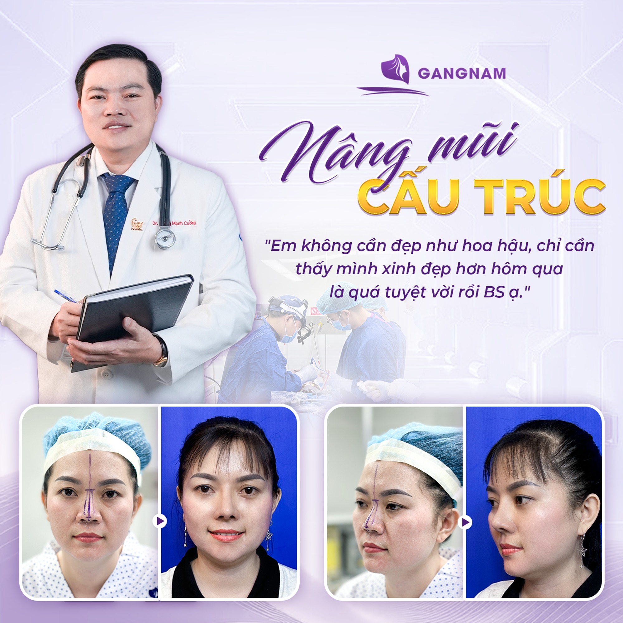 Nâng Mũi Cấu Trúc Thẩm Mỹ: Giải Pháp Tái Tạo Dáng Mũi Đẹp Tự Nhiên 6 Nâng mũi cấu trúc thẩm mỹ tại Thẩm mỹ Gangnam