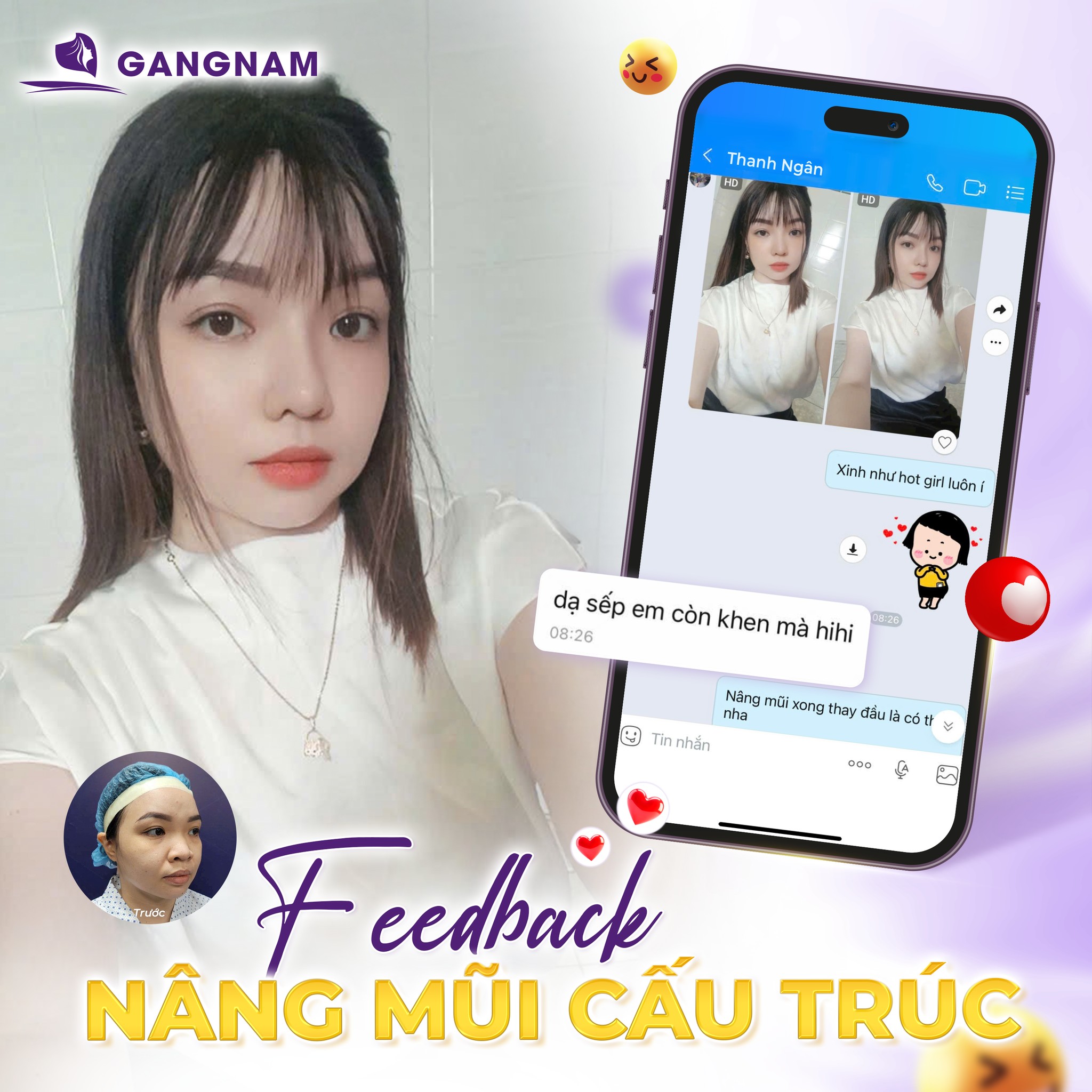 Sửa Mũi Cấu Trúc Nội Soi: Giải Pháp Tái Tạo Dáng Mũi Tự Nhiên, An Toàn 4 Sửa mũi cấu trúc nội soi là gì?