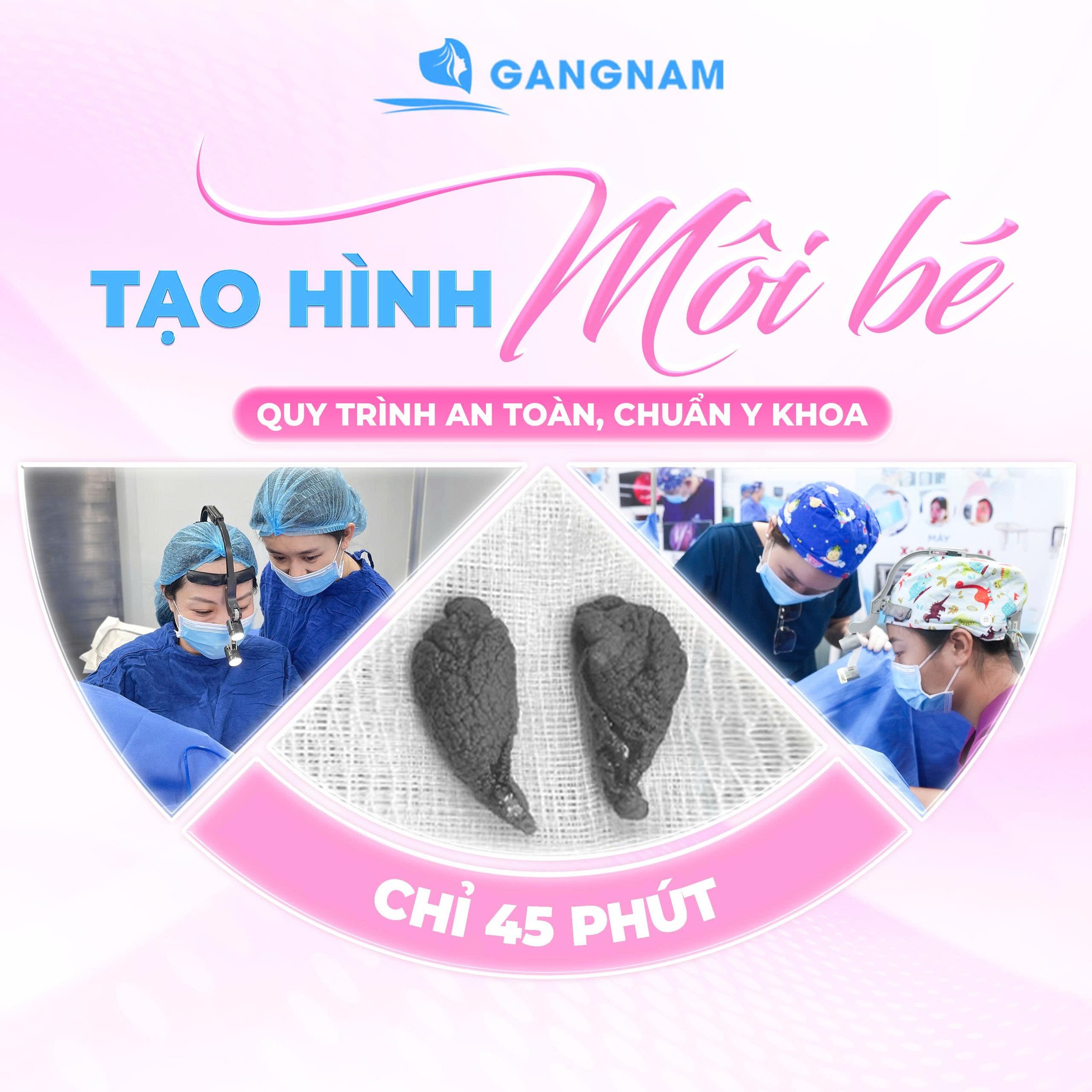 Phẫu thuật tạo hình môi bé: Giải pháp thẩm mỹ và sức khỏe vùng kín hiện đại 4 Phẫu thuật tạo hình môi bé là gì và lý do nên thực hiện