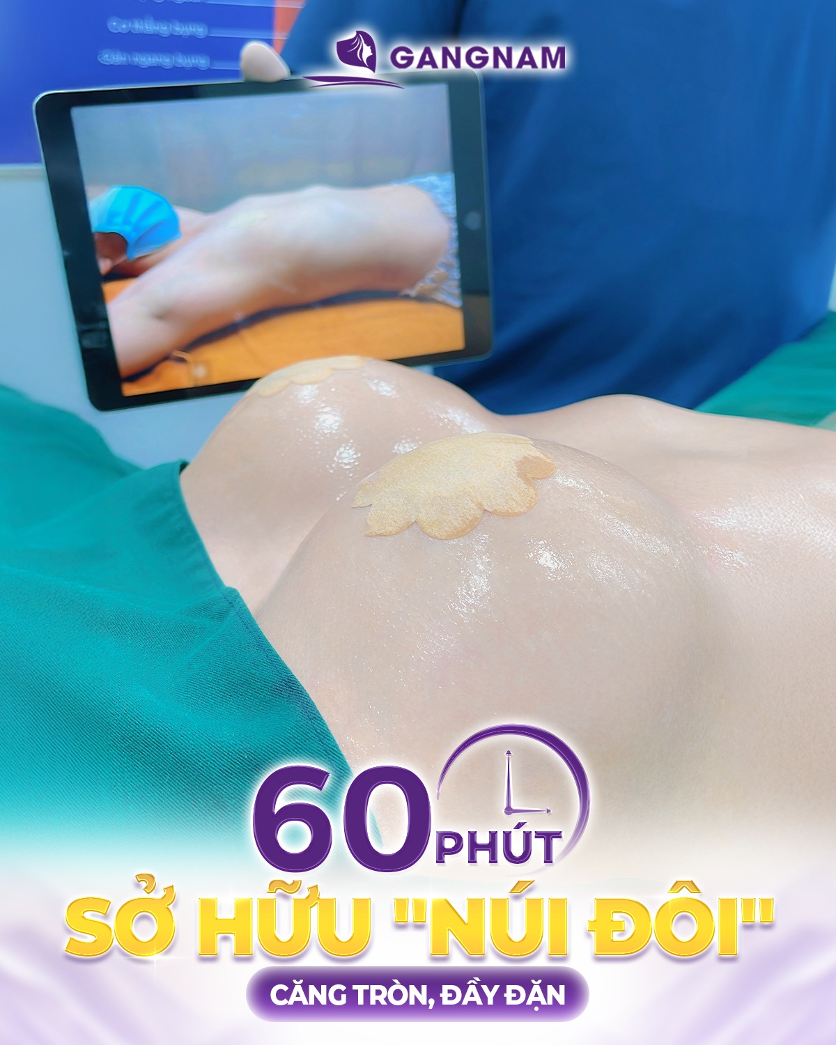 Nâng ngực túi giọt nước: Bí quyết sở hữu vòng 1 tự nhiên 4 Nâng ngực túi giọt nước là gì?