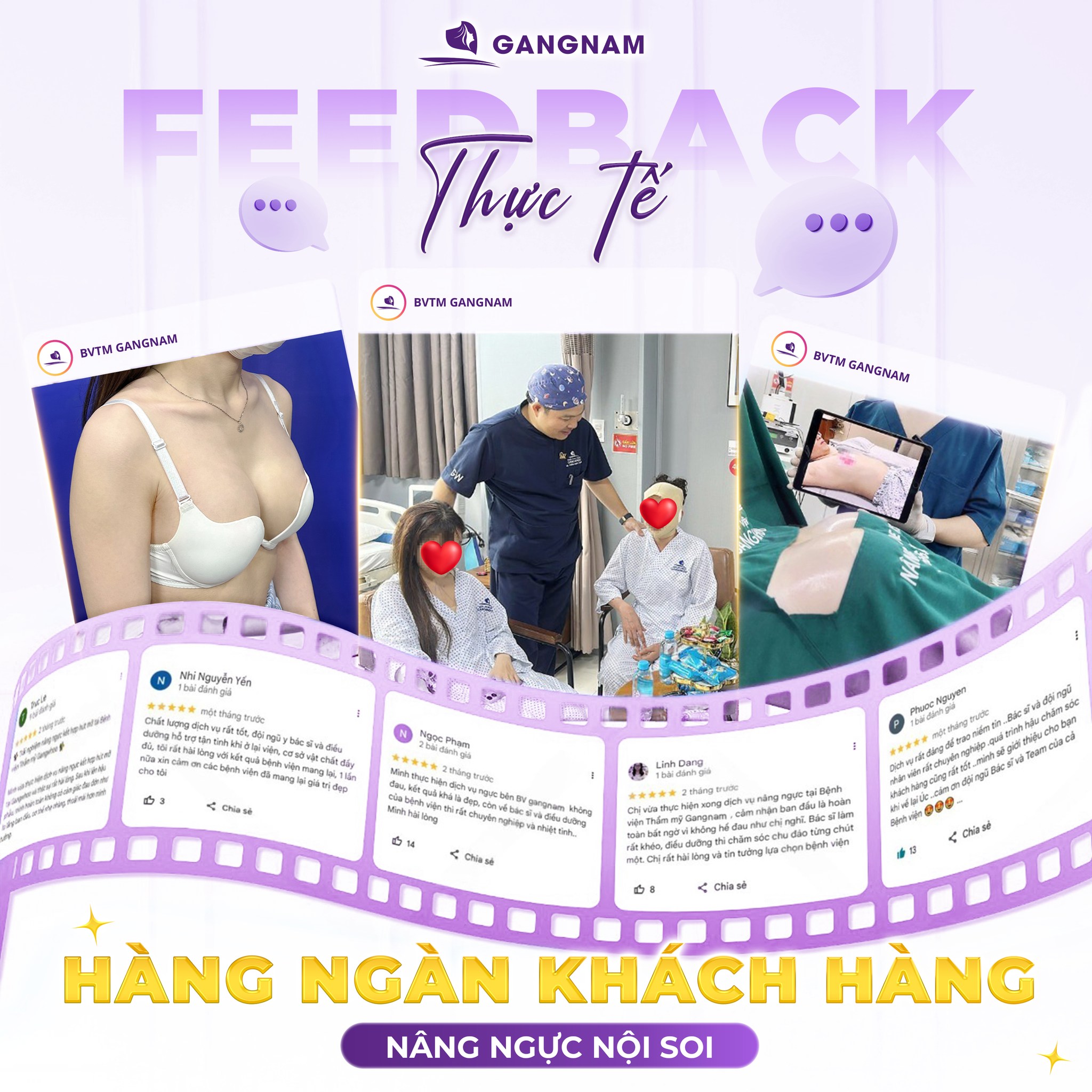 Nâng vòng 1 nội soi 4k – giải pháp nâng ngực hiện đại cho vòng một hoàn hảo 4 Nâng vòng 1 nội soi 4k là gì và cơ chế hoạt động của công nghệ này