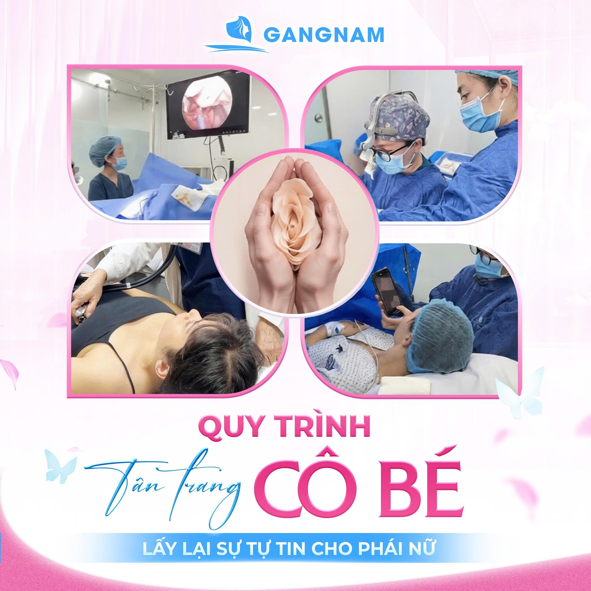 Phẫu thuật tạo hình môi bé: Giải pháp thẩm mỹ và sức khỏe vùng kín hiện đại 5 Quy trình phẫu thuật tạo hình môi bé chi tiết