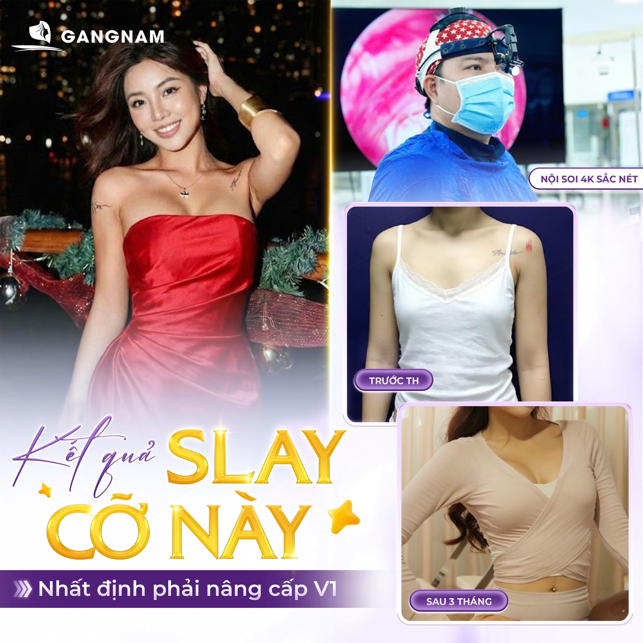 Nâng vòng 1 nội soi 4k – giải pháp nâng ngực hiện đại cho vòng một hoàn hảo 6 Nâng vòng 1 nội soi 4K an toàn, tự nhiên tại Thẩm mỹ Gangnam