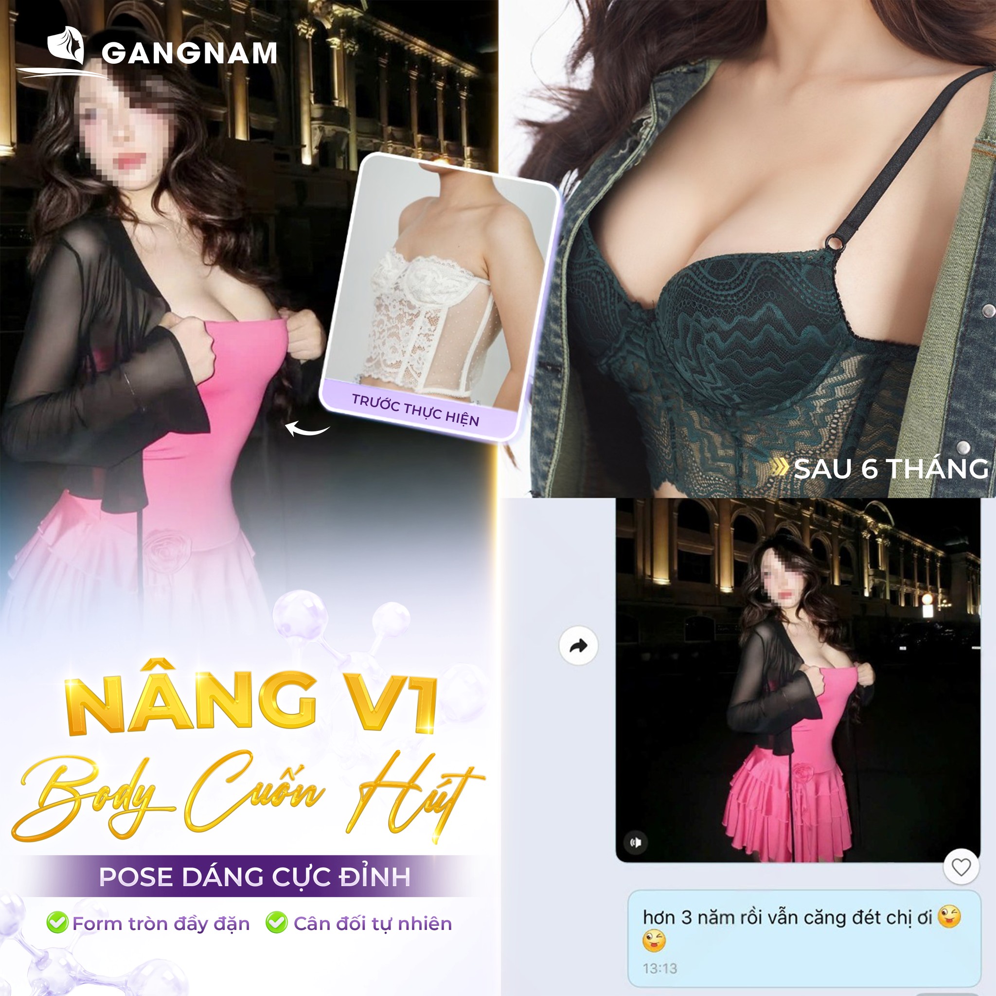 Sửa vòng 1 công nghệ nội soi – giải pháp an toàn và chính xác 6 Sửa vòng 1 công nghệ nội soi tại Thẩm mỹ Gangnam