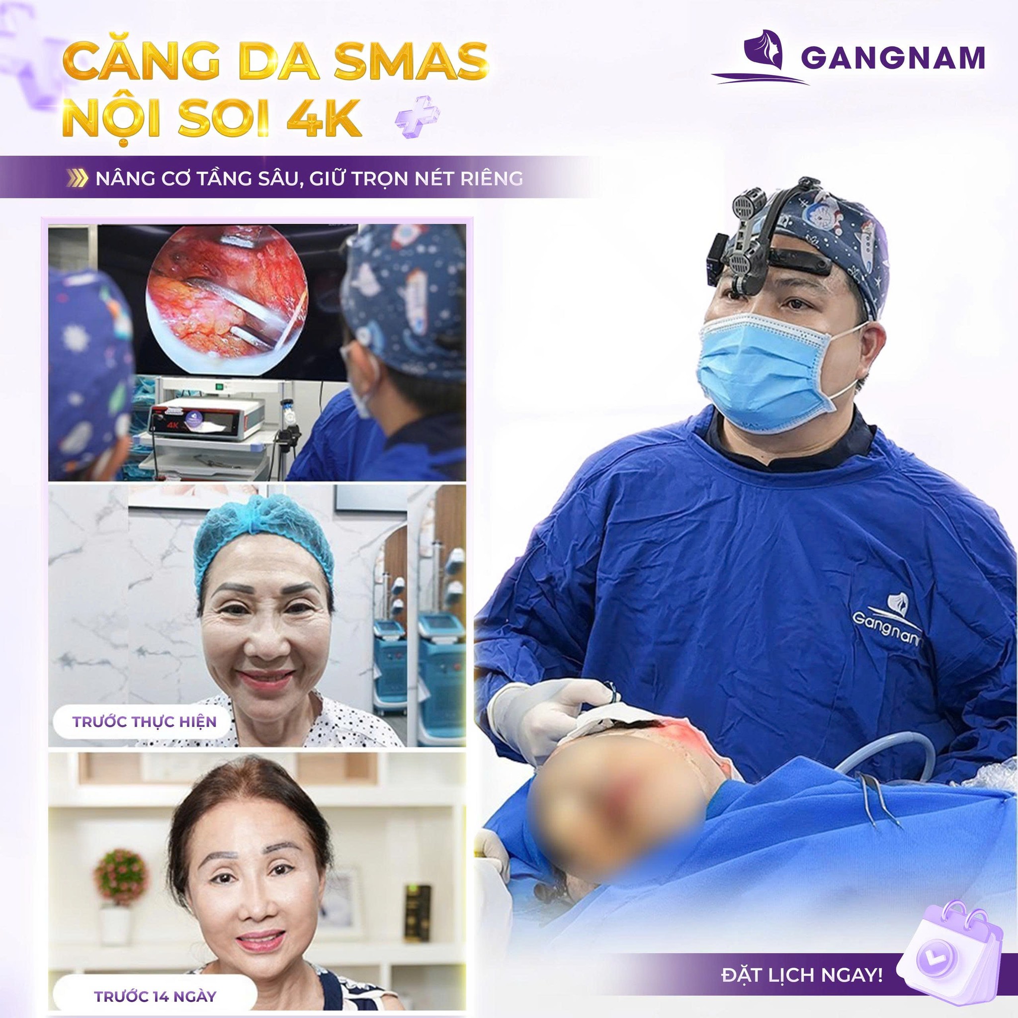 Căng da mặt nội soi – giải pháp trẻ hóa da mặt tự nhiên ít xâm lấn nhất hiện nay 6 Căng da mặt nội soi tại Thẩm mỹ Gangnam – Trẻ hóa an toàn, giữ trọn nét tự nhiên