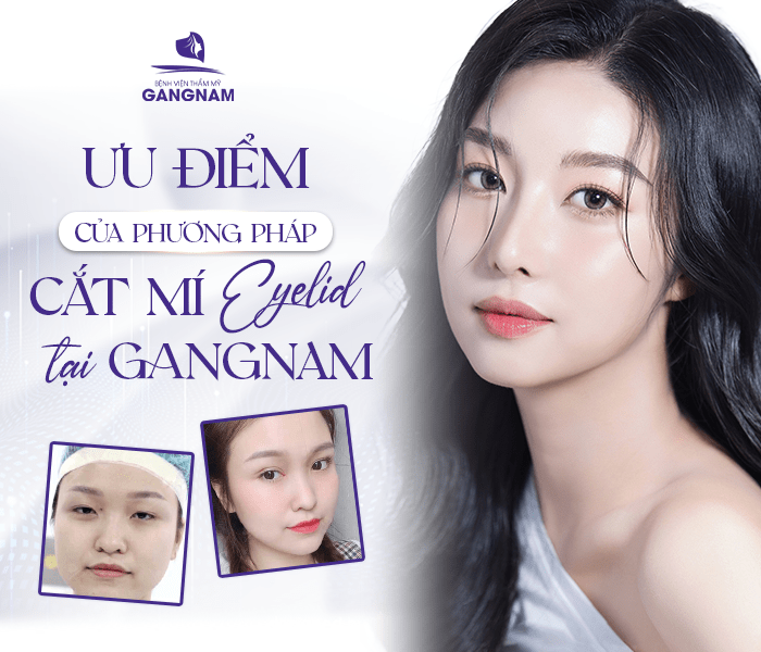 Cắt mí trên Eyelid tự nhiên – giải pháp trẻ hóa đôi mắt thanh thoát và hài hòa 5 Các kỹ thuật cắt mí trên Eyelid tự nhiên phổ biến hiện nay