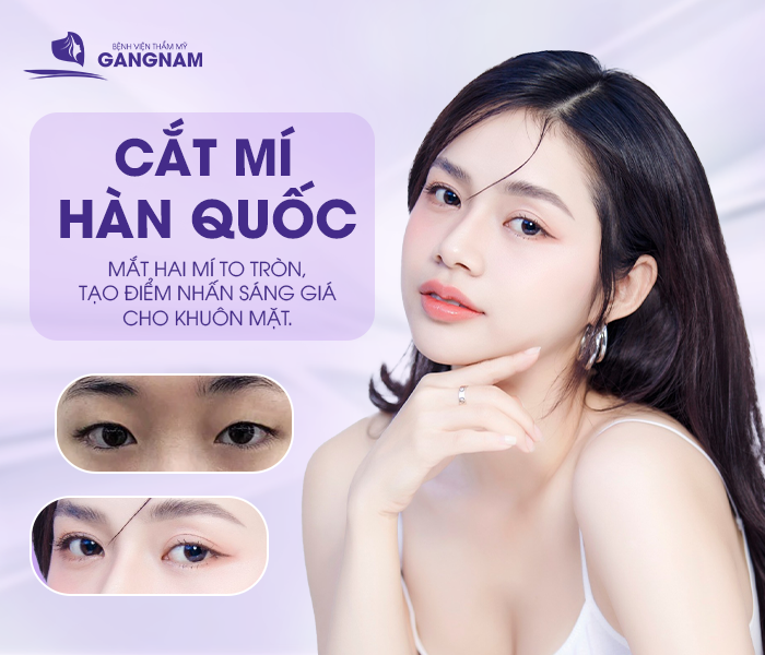 Cắt Mí Công Nghệ Hàn Quốc Là Gì? Ưu Điểm, Công Nghệ Mới 4 Cắt mí công nghệ Hàn Quốc là gì và tại sao được ưa chuộng