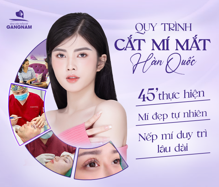 Cắt Mí Công Nghệ Hàn Quốc Là Gì? Ưu Điểm, Công Nghệ Mới 5 Các kỹ thuật phổ biến trong cắt mí công nghệ Hàn Quốc