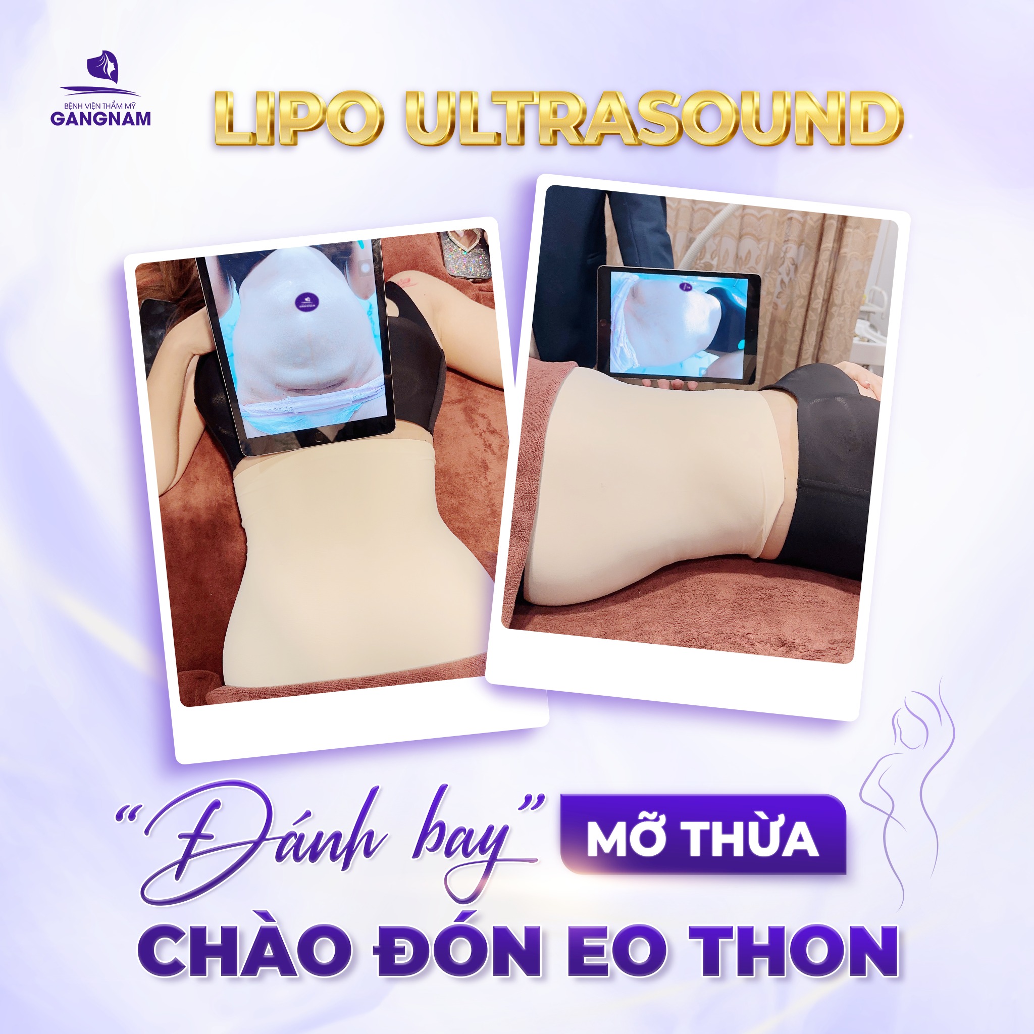 Công nghệ hút mỡ eo Lipo Ultrasound: Giải pháp tạo hình vòng eo thon gọn hiện đại 4 Cơ chế hoạt động của công nghệ hút mỡ eo Lipo Ultrasound