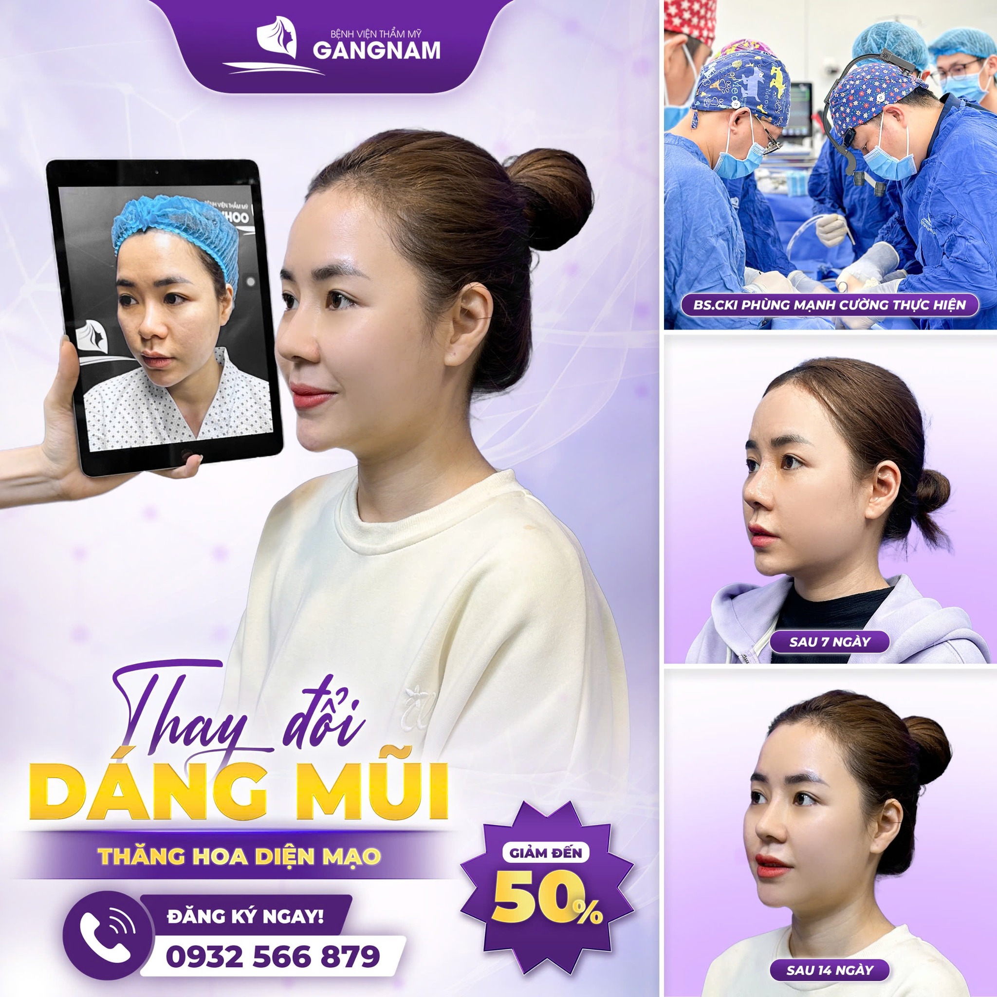 Nâng Mũi S Line Bọc Sụn – Giải Pháp Tạo Dáng Mũi Tự Nhiên, An Toàn 5 Sự kết hợp chất liệu trong nâng mũi S line bọc sụn