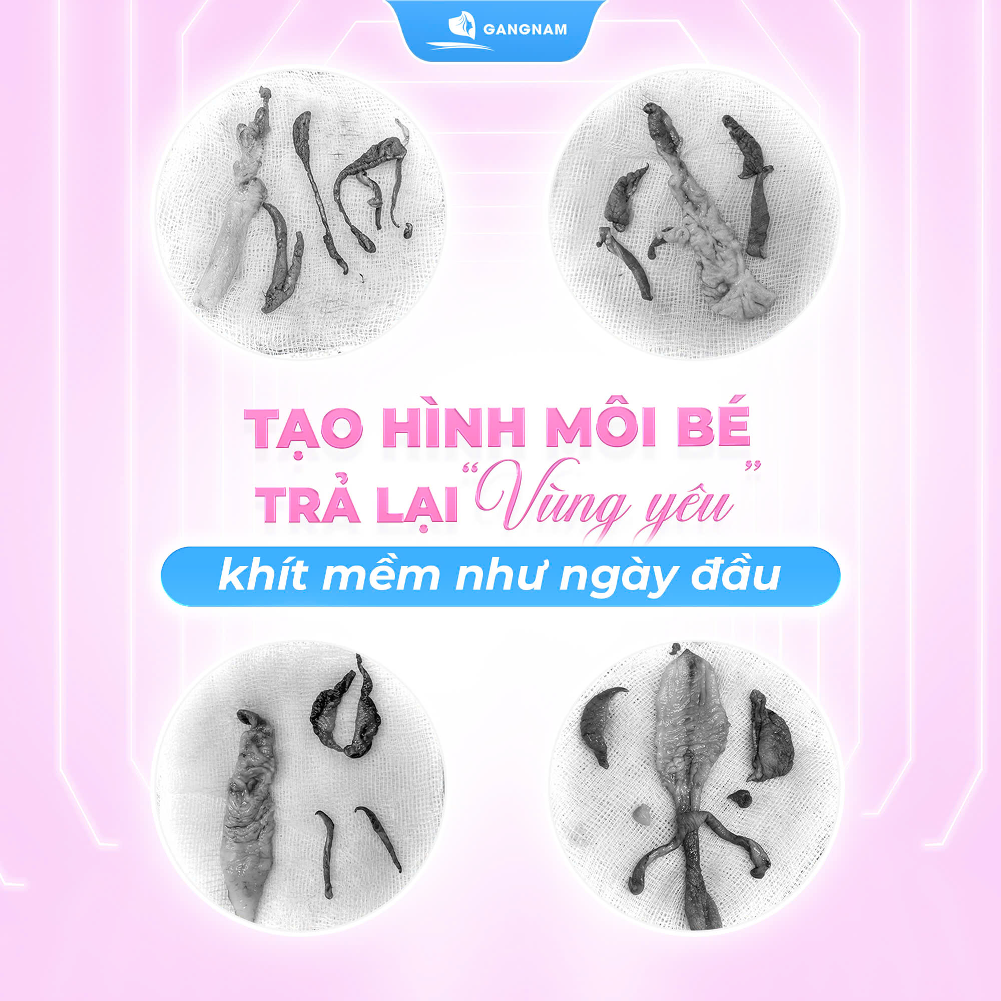 Cắt môi bé nhẹ nhàng: Giải pháp thẩm mỹ hiện đại giúp chị em tự tin hơn 4 Tại sao phái đẹp nên thực hiện cắt môi bé nhẹ nhàng?