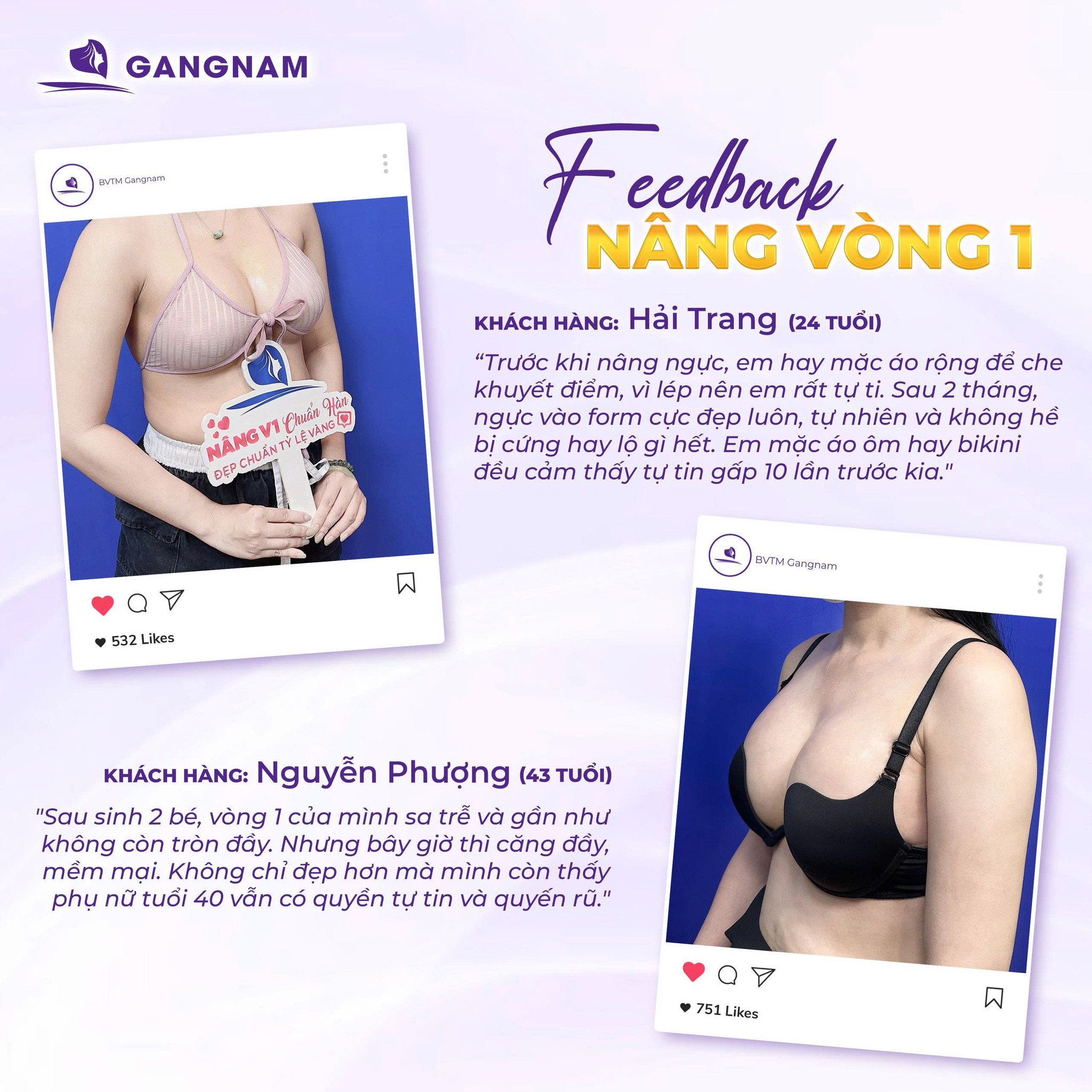 Nâng Ngực Đặt Túi Độn: Giải Pháp Tăng Vòng 1 Tự Nhiên, An Toàn Chuẩn Y Khoa 5 Nâng Ngực Đặt Túi Độn: Giải Pháp Tăng Vòng 1 Tự Nhiên, An Toàn Chuẩn Y Khoa 2