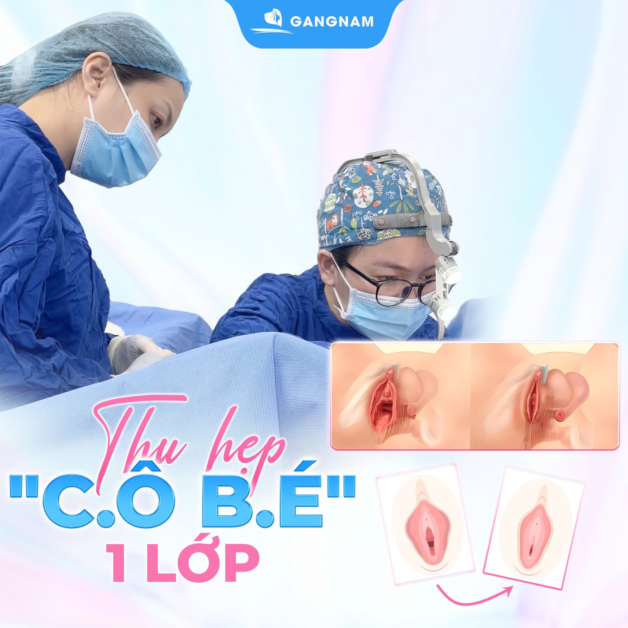 Thu Hẹp Vùng Kín: Giải Pháp Lấy Lại Sự Tự Tin Và Săn Chắc Tự Nhiên 5 Phẫu thuật thu hẹp vùng kín – giải pháp cho trường hợp giãn rộng nặng