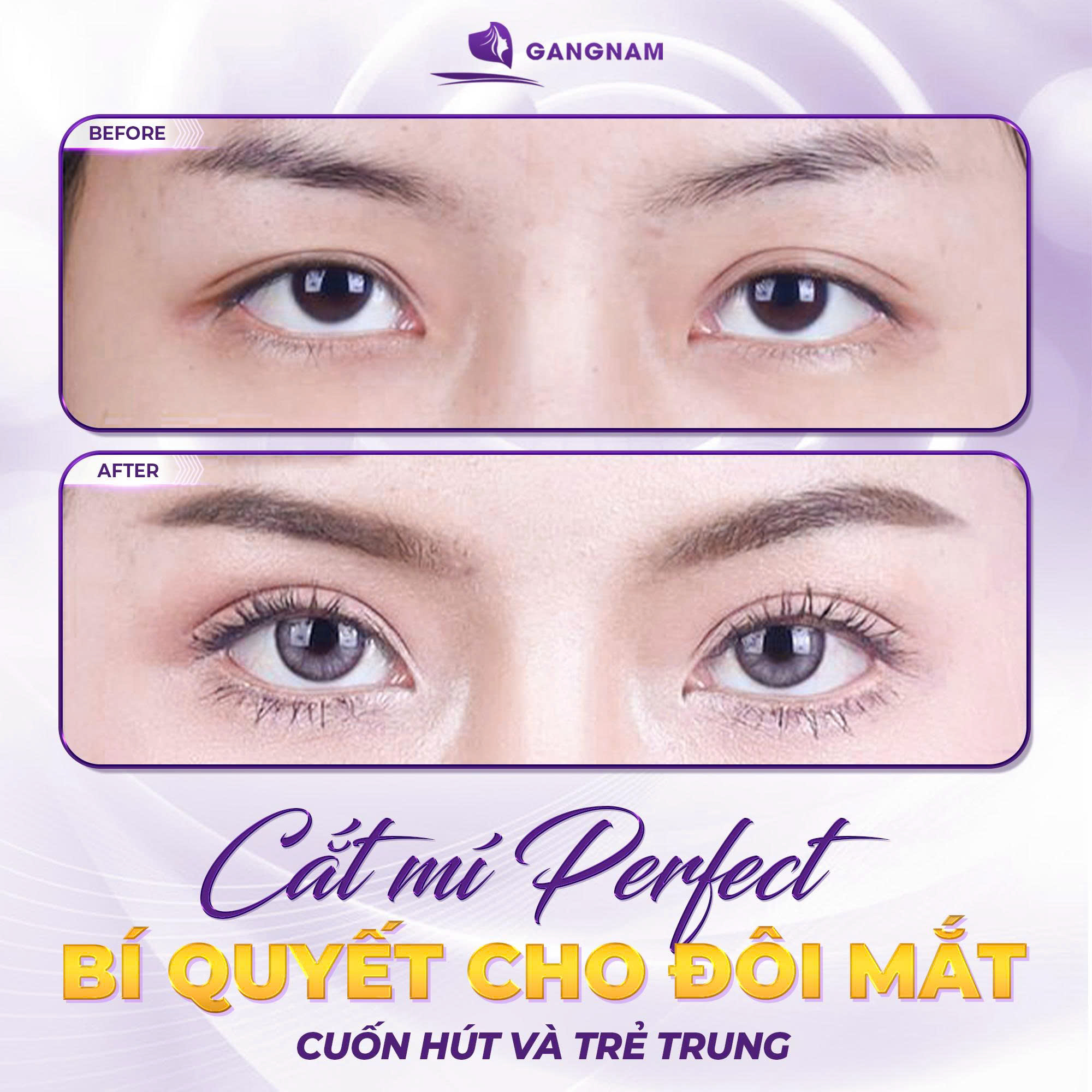 Cắt Mí Chuẩn Y Khoa: Giải Pháp Tạo Mắt Hai Mí Tự Nhiên, An Toàn Và Lâu Dài 6 Thẩm mỹ Gangnam – Kiến tạo vẻ đẹp tự nhiên và hài hòa