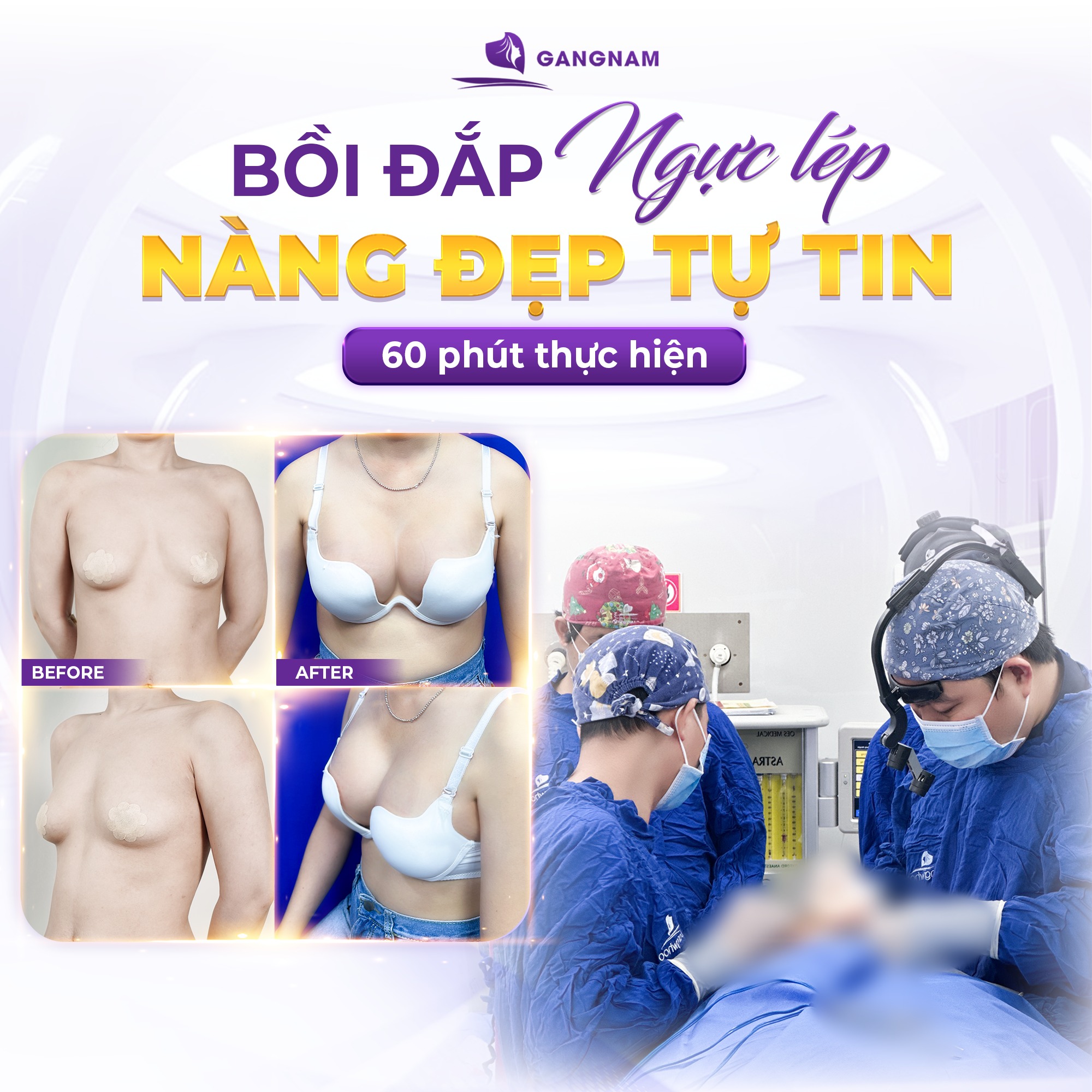 Nâng ngực nội soi 4K túi Mentor: Giải pháp vàng cho vòng 1 hoàn hảo 6 Nâng ngực nội soi 4K túi Mentor tại Thẩm mỹ Gangnam