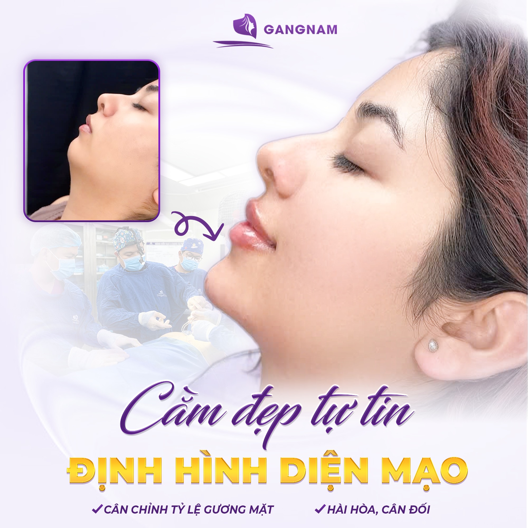 Độn cằm nội soi thẩm mỹ: Giải pháp tạo dáng V-line an toàn, tự nhiên và lâu dài 5 Quy trình thực hiện độn cằm nội soi thẩm mỹ tiêu chuẩn