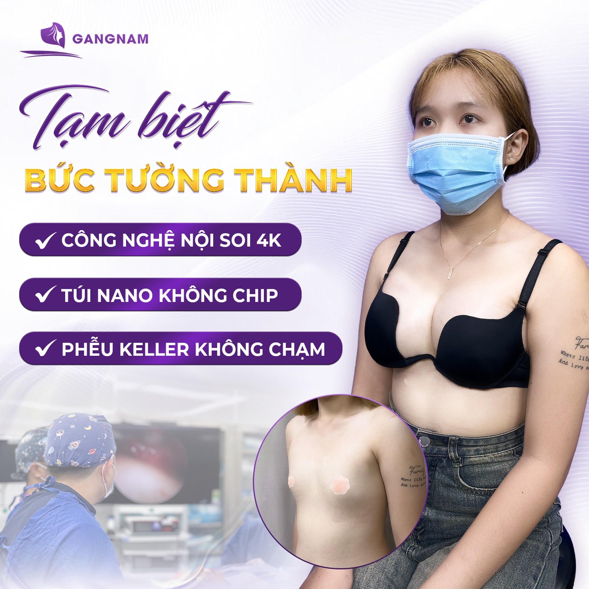 Nâng Ngực Đặt Túi Độn: Giải Pháp Tăng Vòng 1 Tự Nhiên, An Toàn Chuẩn Y Khoa 4 Nâng ngực đặt túi độn là gì