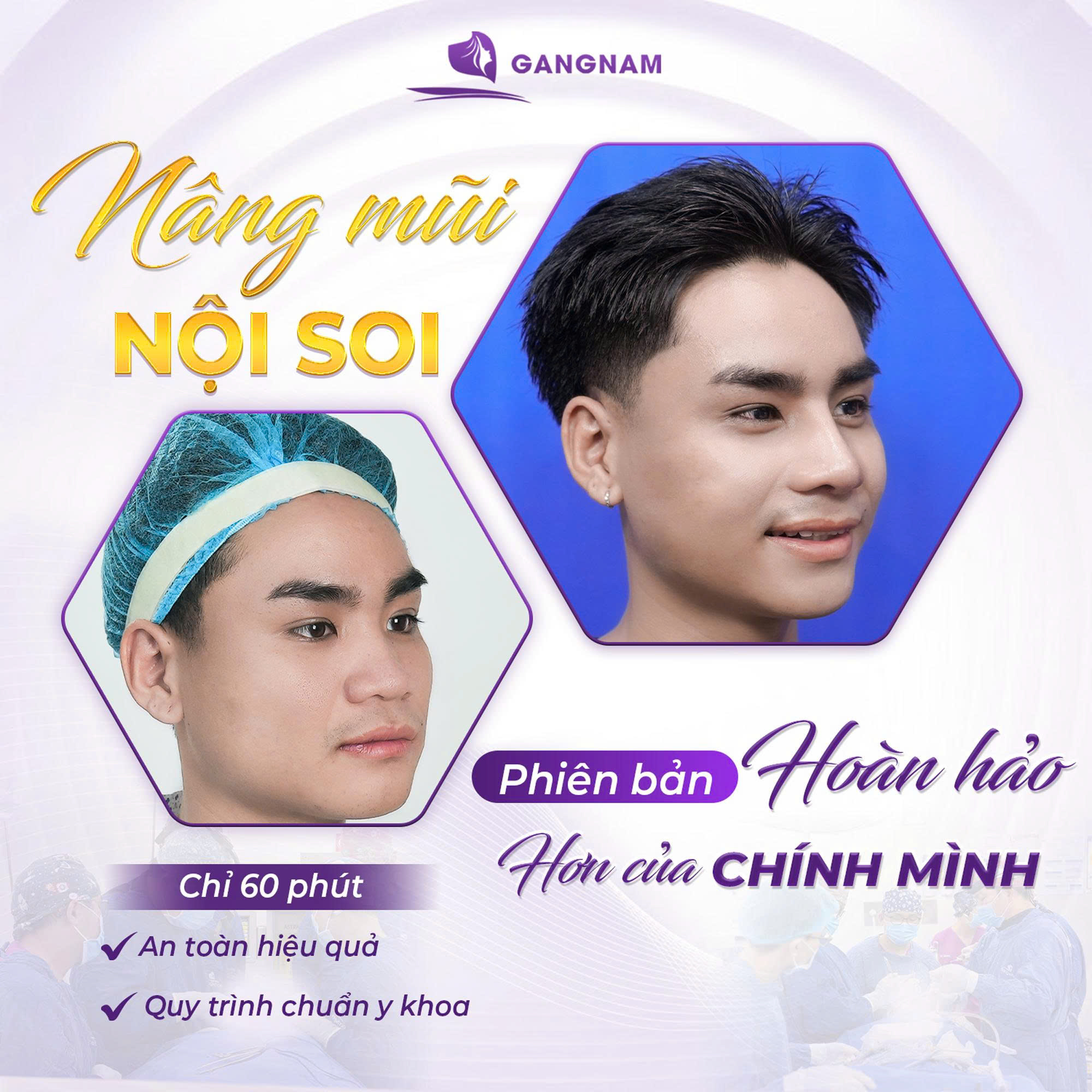 Nâng mũi nội soi hiện đại – Xu hướng thẩm mỹ mũi an toàn, bền vững hiện nay 5 Kỹ thuật nâng mũi cấu trúc trong nâng mũi nội soi hiện đại
