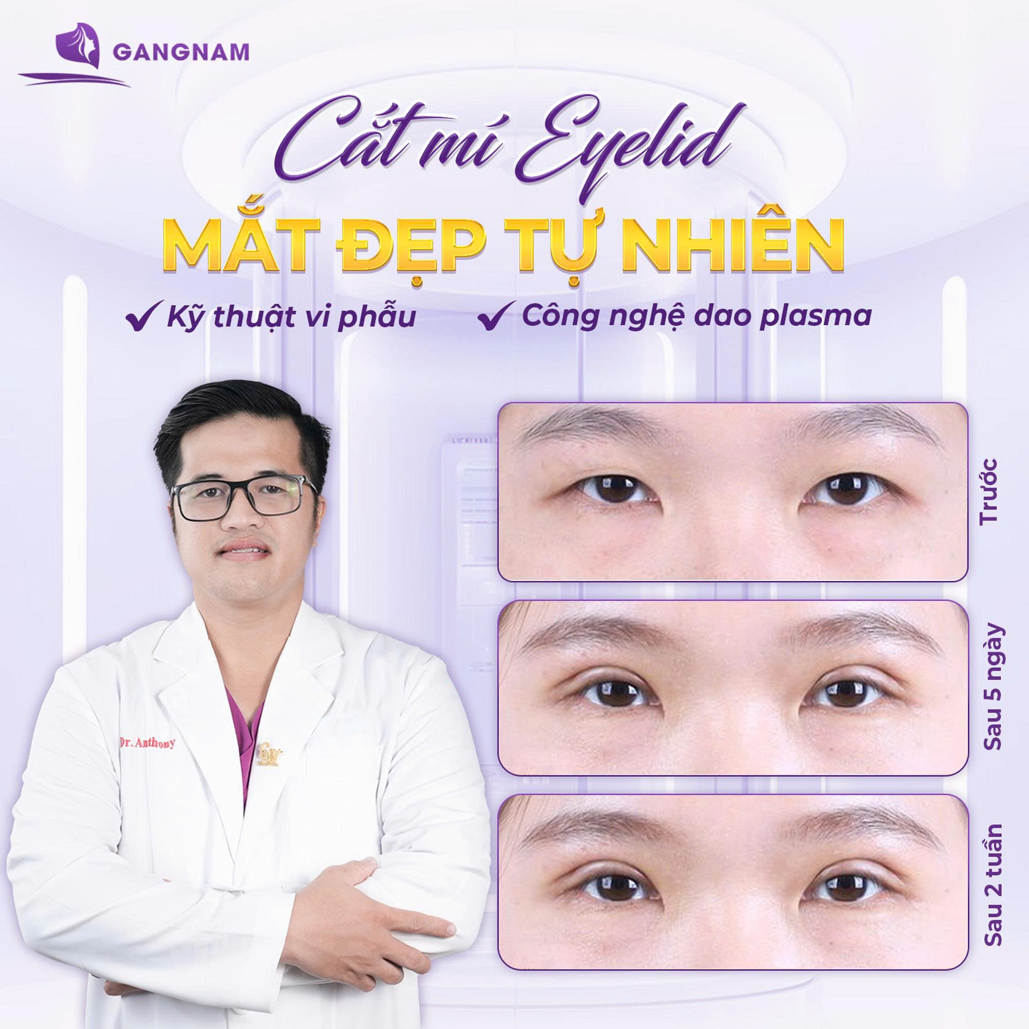 Cắt Mí Eyelid Hiện Đại: Bí Quyết Sở Hữu Đôi Mắt Trẻ Trung, Hài Hòa Tự Nhiên 5 Công nghệ hỗ trợ trong cắt mí Eyelid hiện đại: Không sưng – Không đau