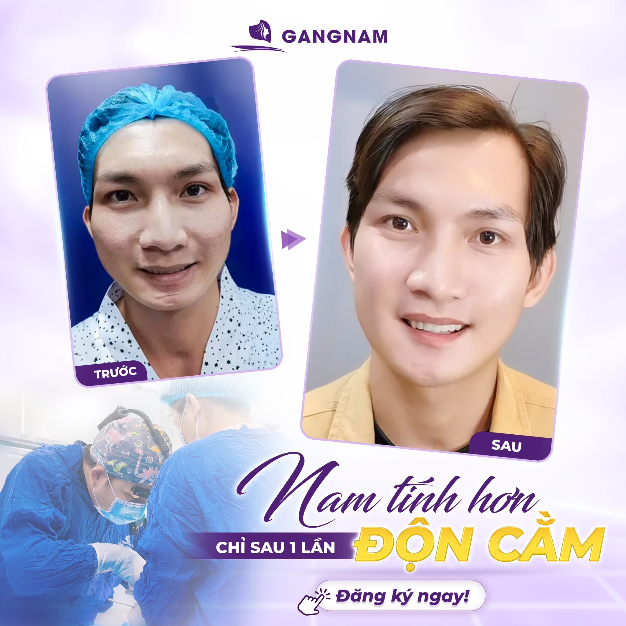 Độn Cằm Vline Thẩm Mỹ – Giải Pháp Tạo Dáng Cằm Chuẩn Tỷ Lệ Vàng 5 Công nghệ nội soi 4K nâng tầm độn cằm Vline thẩm mỹ
