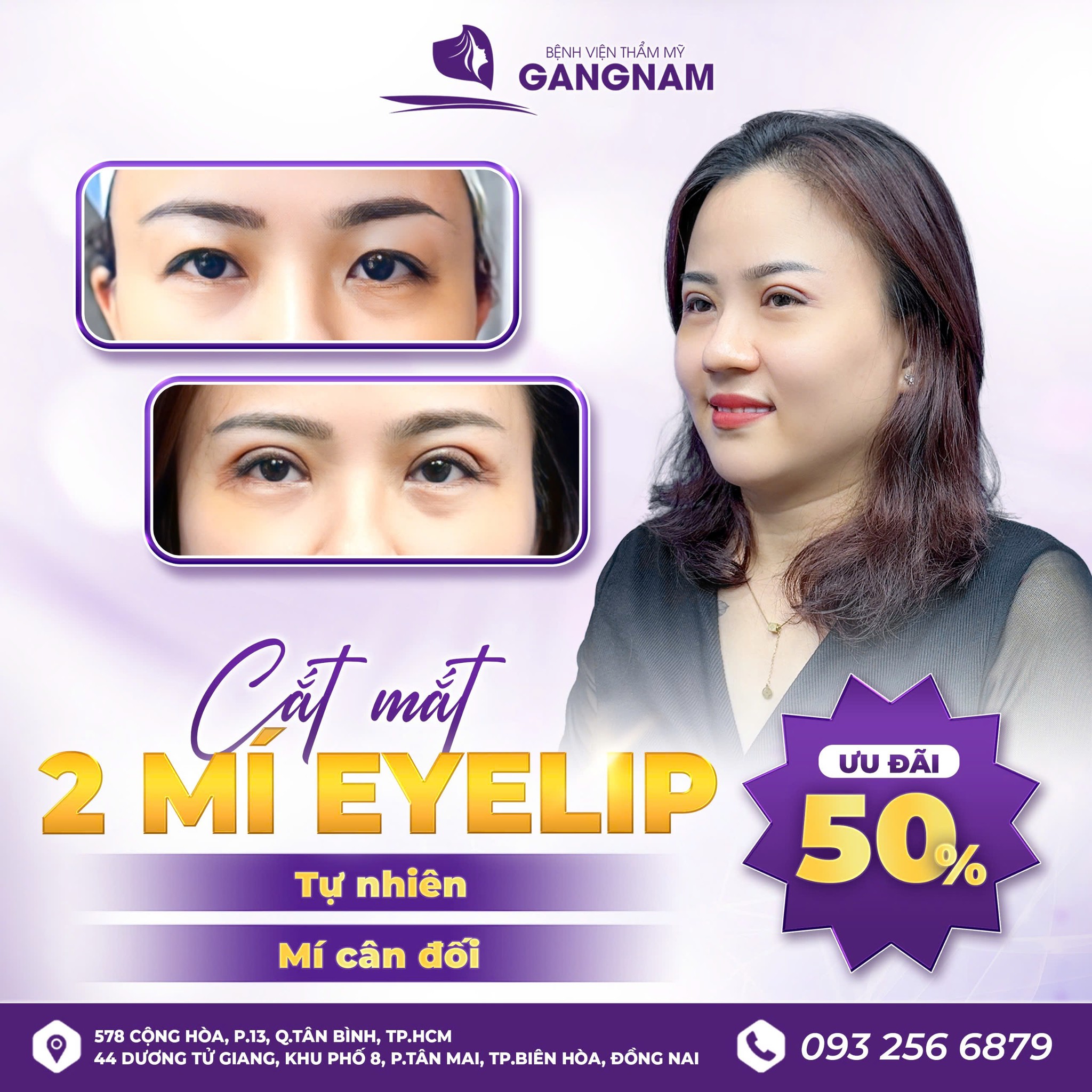 Cắt mí mắt thẩm mỹ: Giải pháp trẻ hóa đôi mắt an toàn, hiệu quả 4 Cắt mí mắt thẩm mỹ là gì và các kỹ thuật phổ biến hiện nay