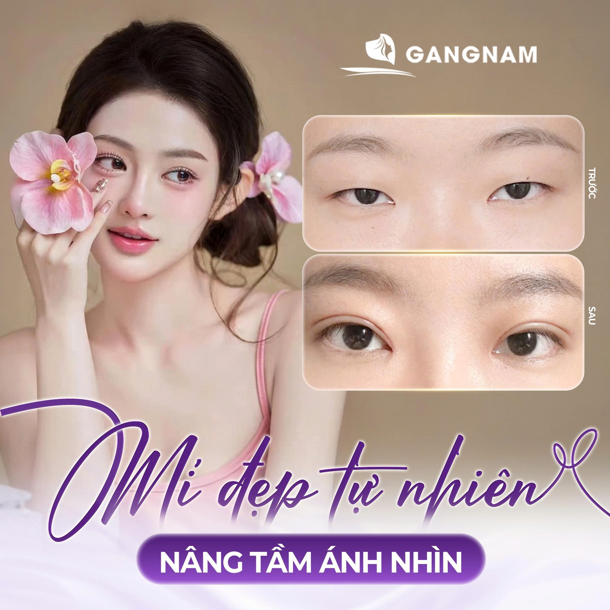 Cắt mí mắt Hàn Quốc: Giải pháp hoàn hảo cho đôi mắt hai mí đẹp tự nhiên 6 Thẩm mỹ Gangnam – Đồng hành cùng hành trình hoàn thiện nhan sắc