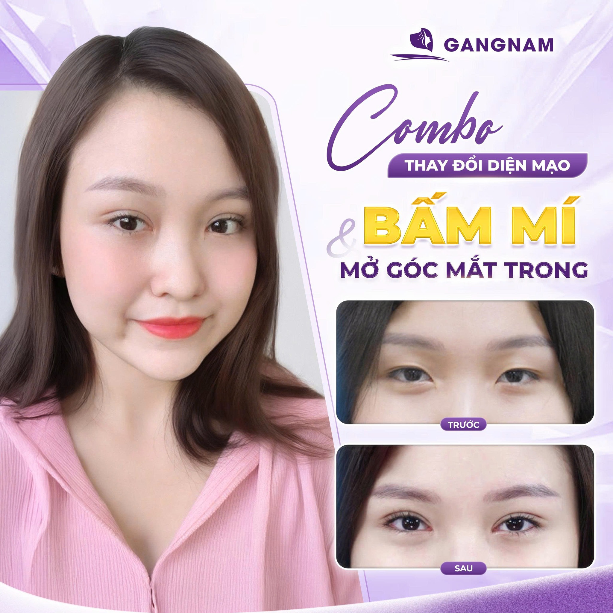 Cắt mí style Hàn Quốc: Bí quyết sở hữu đôi mắt to tròn, tự nhiên 4 Cắt mí style Hàn Quốc là gì và tại sao lại gây sốt?