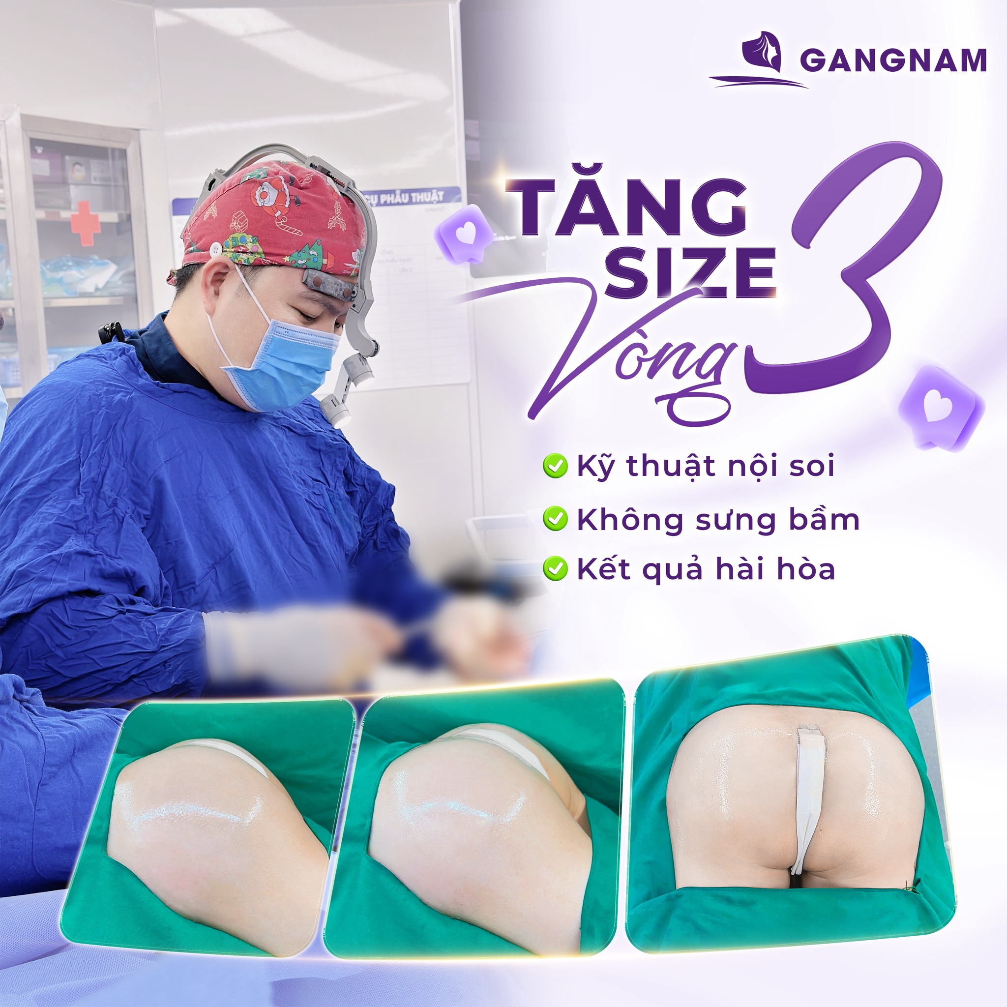 Nâng Mông Nội Soi 4K Sexy: Công Nghệ Tạo Dáng Vòng 3 Quyến Rũ, An Toàn 6 Thẩm mỹ Gangnam – Địa chỉ nâng mông nội soi 4K sexy uy tín, chuẩn y khoa
