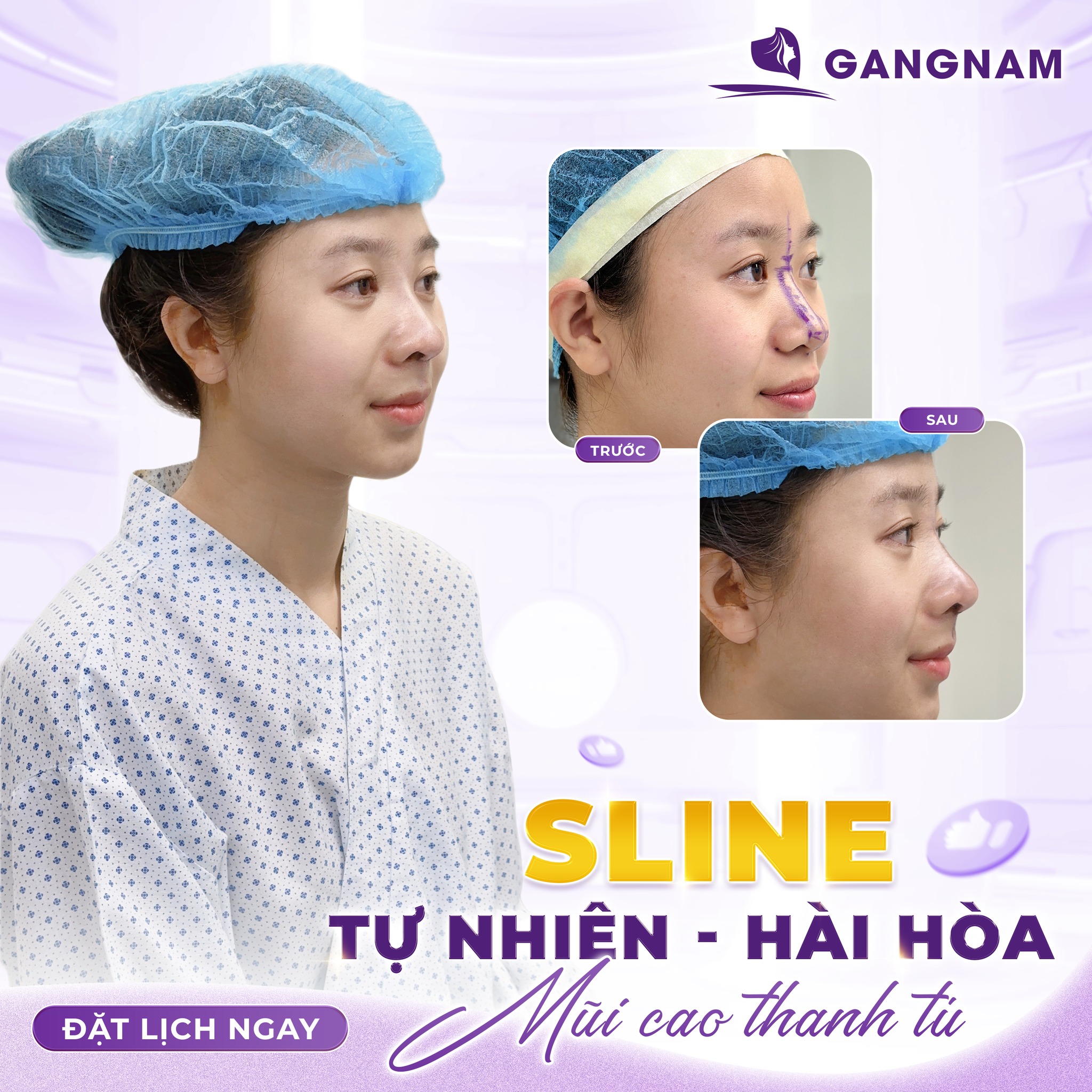 Nâng Mũi Dáng S-Line: Bí Quyết Sở Hữu Dáng Mũi Tự Nhiên, Hài Hòa Chuẩn Á Đông 6 Thẩm mỹ Gangnam – Kiến tạo vẻ đẹp tự nhiên chuẩn y khoa