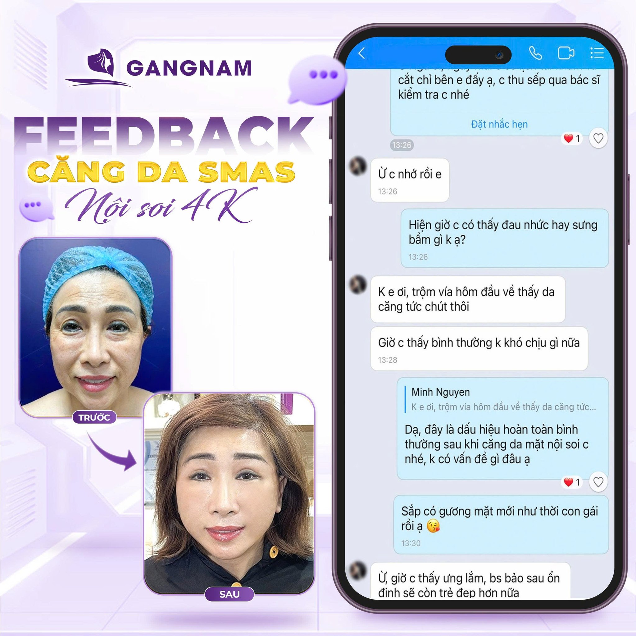 Phẫu Thuật Căng Da SMAS: Giải Pháp Trẻ Hóa Toàn Diện Duy Trì Lâu Dài 5 Quy trình thực hiện phẫu thuật căng da SMAS