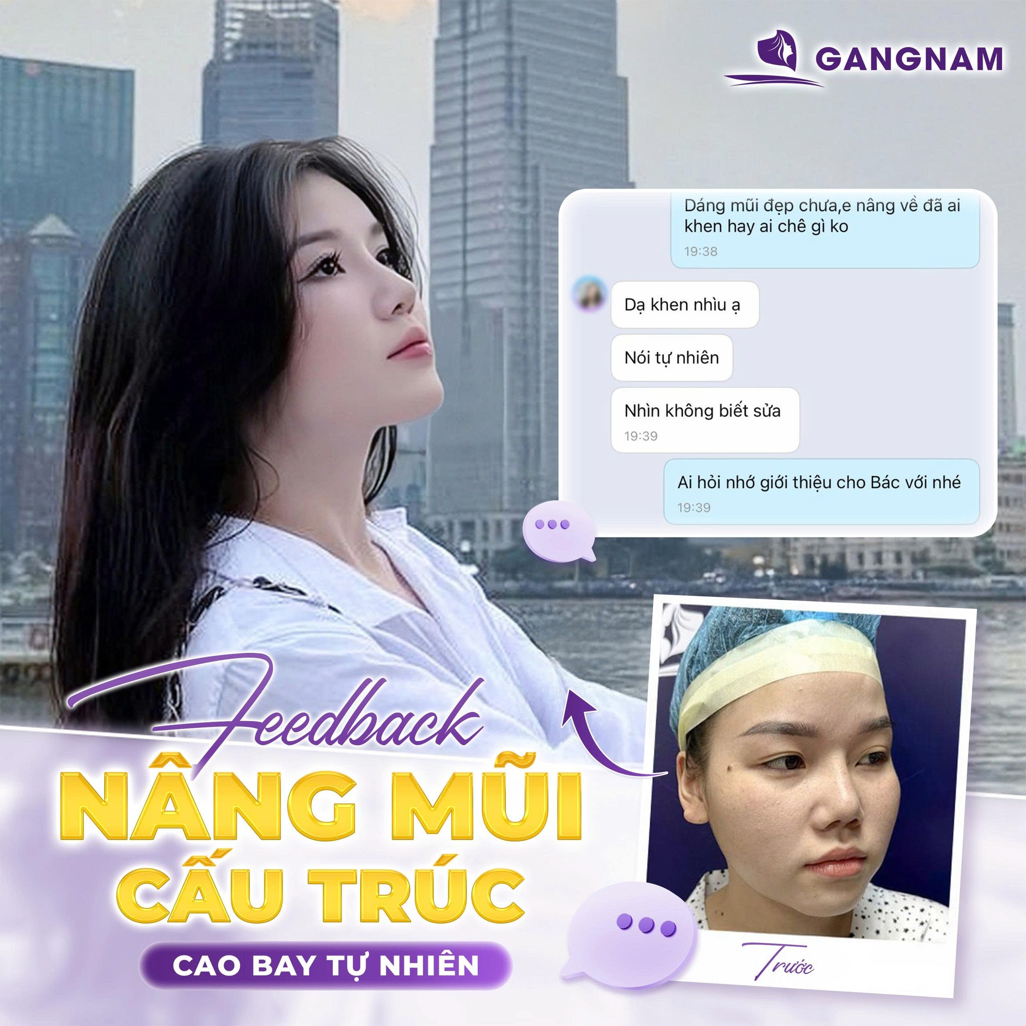 Nâng Mũi Cấu Trúc Nội Soi – Giải Pháp Tái Cấu Trúc Toàn Diện Dáng Mũi Hiện Đại 6 NÂNG MŨI CẤU TRÚC NỘI SOI – TẠO DÁNG MŨI THANH THOÁT