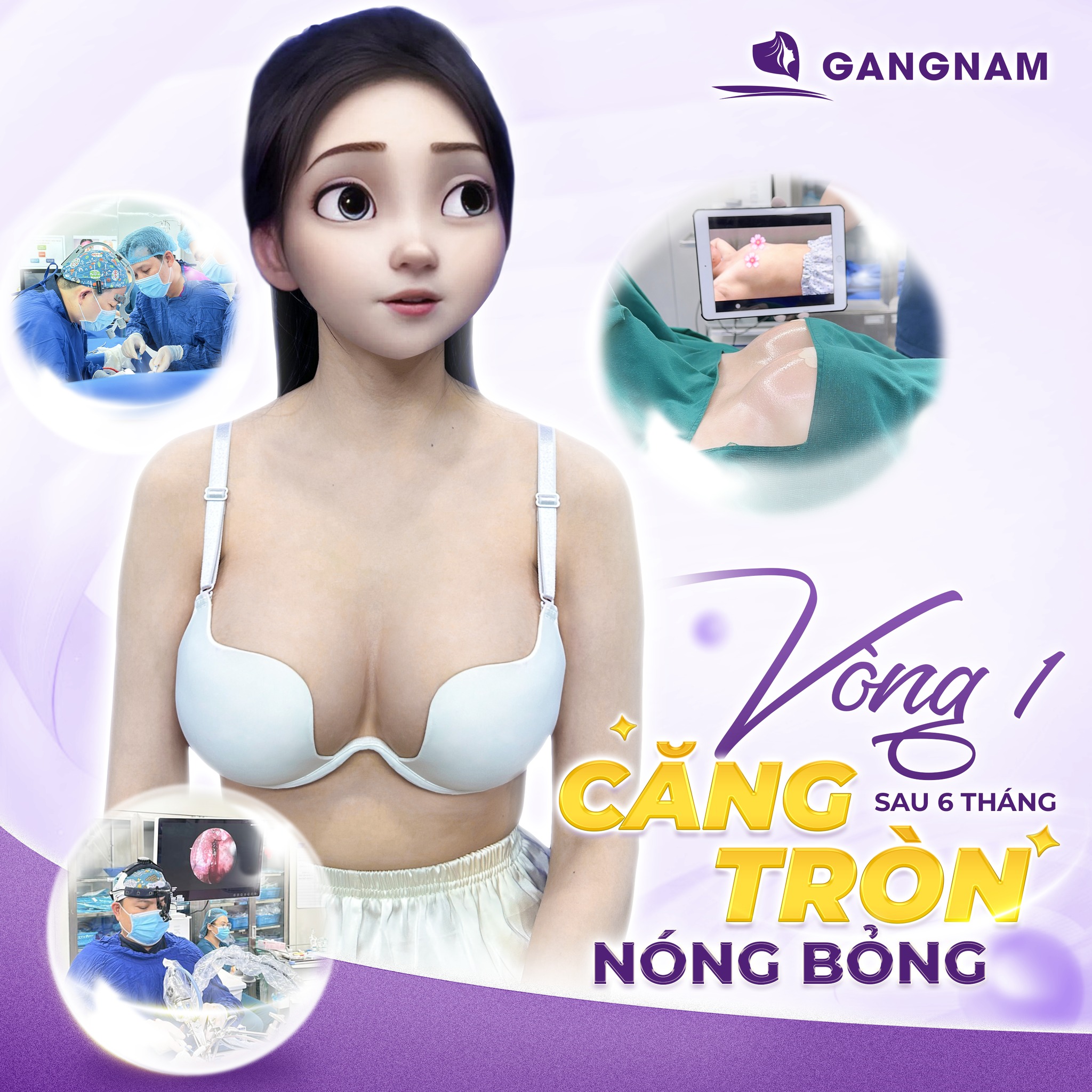 Nâng vòng 1 căng đầy tự nhiên và an toàn với công nghệ hiện đại 6 Nâng vòng 1 căng đầy tại Thẩm mỹ Gangnam