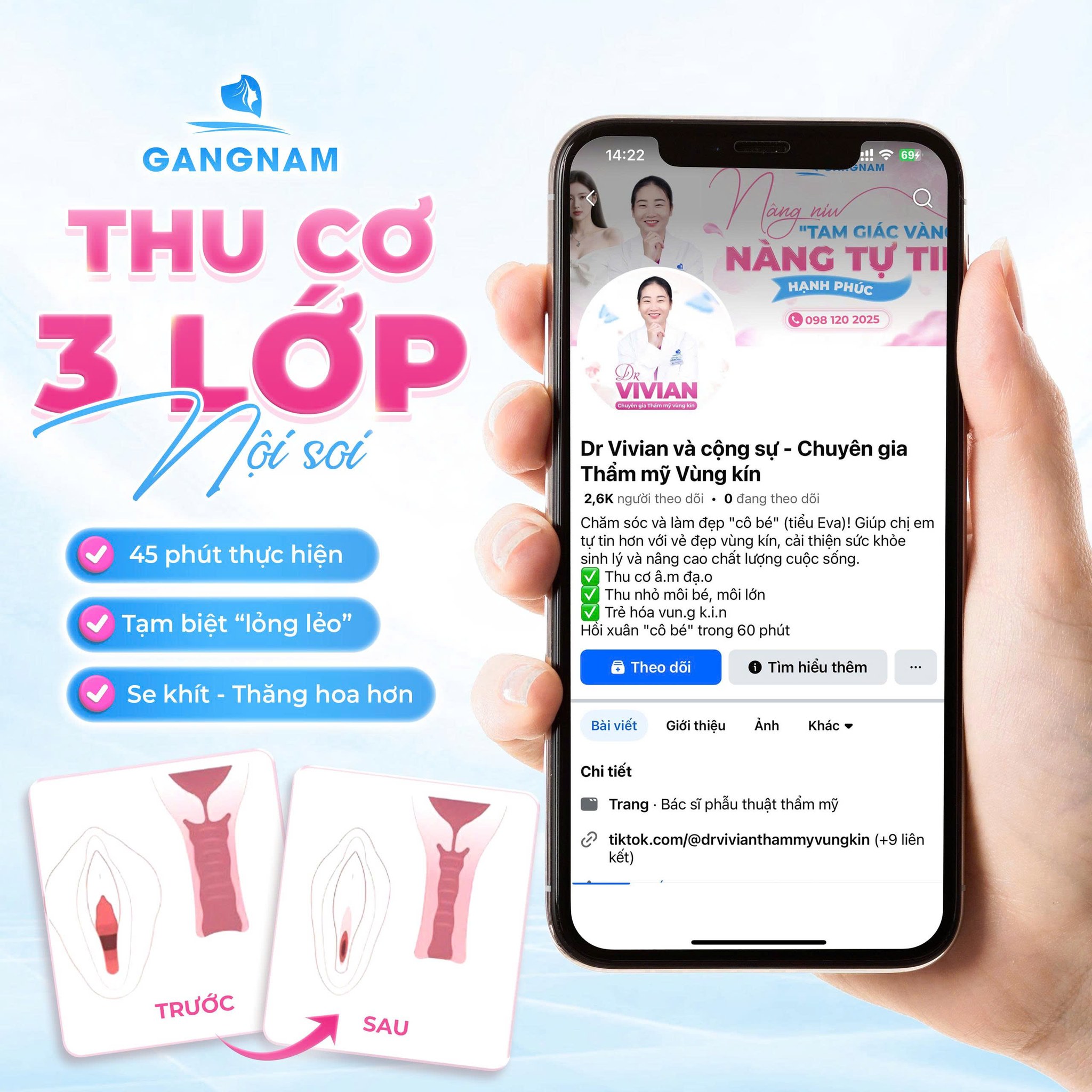 Thu cơ âm đạo nội soi: Giải pháp phục hồi săn chắc và thẩm mỹ vùng kín an toàn 6 Quy trình thực hiện thu cơ âm đạo nội soi chi tiết