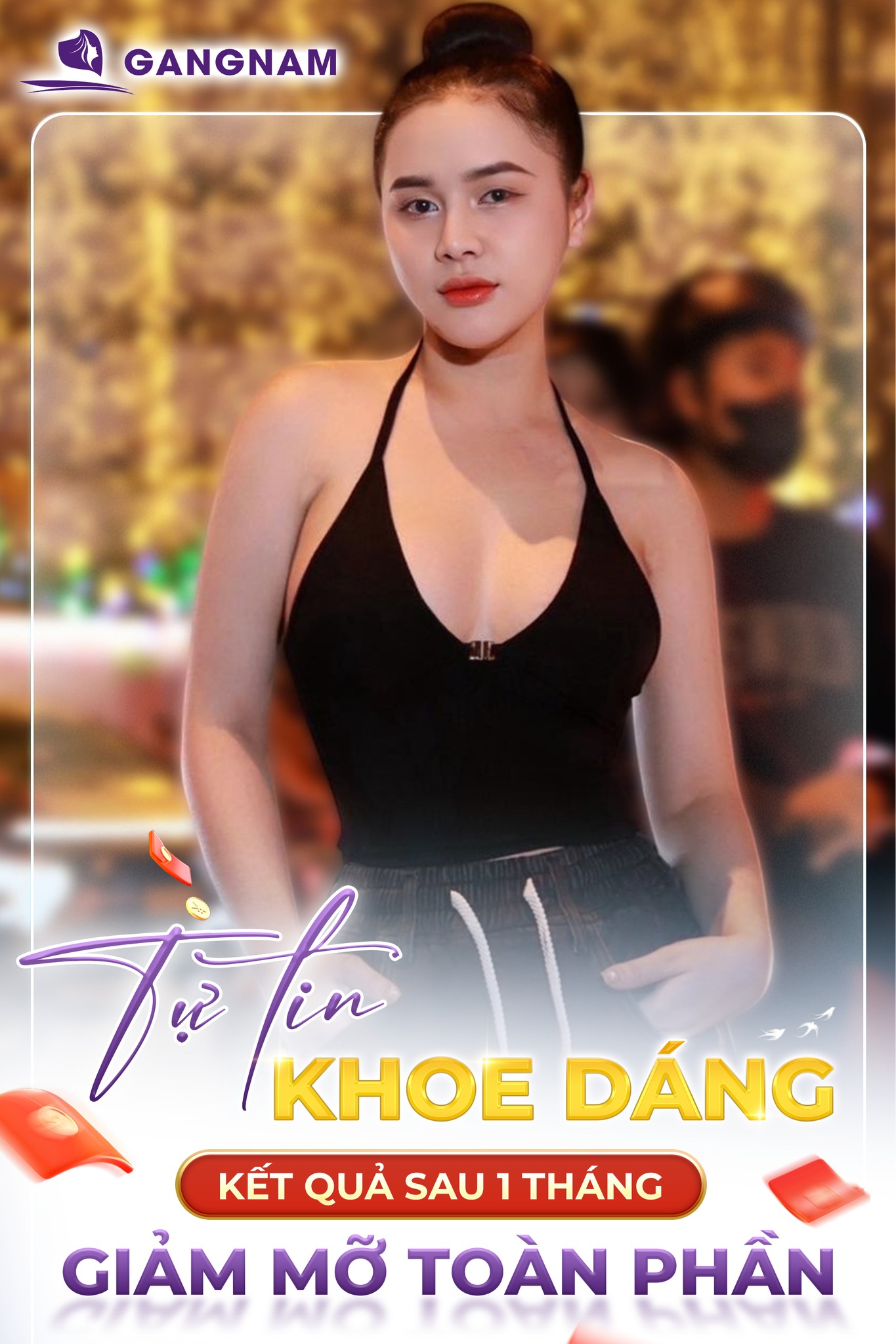 Giảm Mỡ Vòng 2 Lipo Thon Gọn: Giải Pháp Hiện Đại Cho Vòng Eo Săn Chắc 4 Giảm mỡ vòng 2 Lipo thon gọn là gì