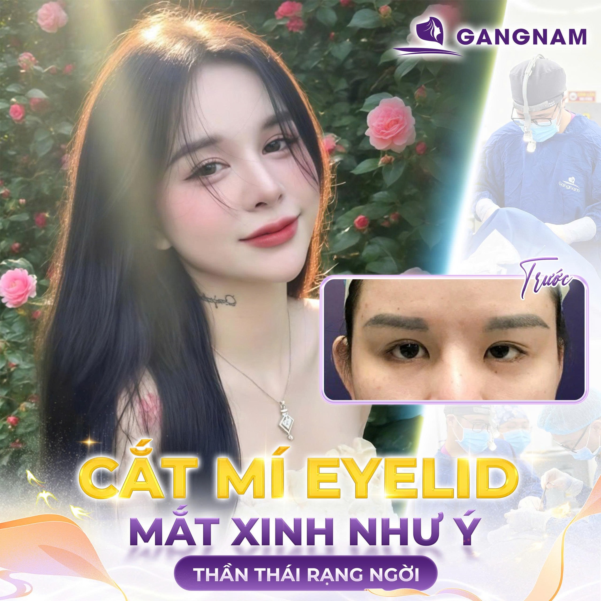 Cắt mí thẩm mỹ Eyelid: Giải pháp trẻ hóa đôi mắt an toàn, hiệu quả lâu dài 6 Cắt mí thẩm mỹ Eyelid tại Thẩm mỹ Gangnam