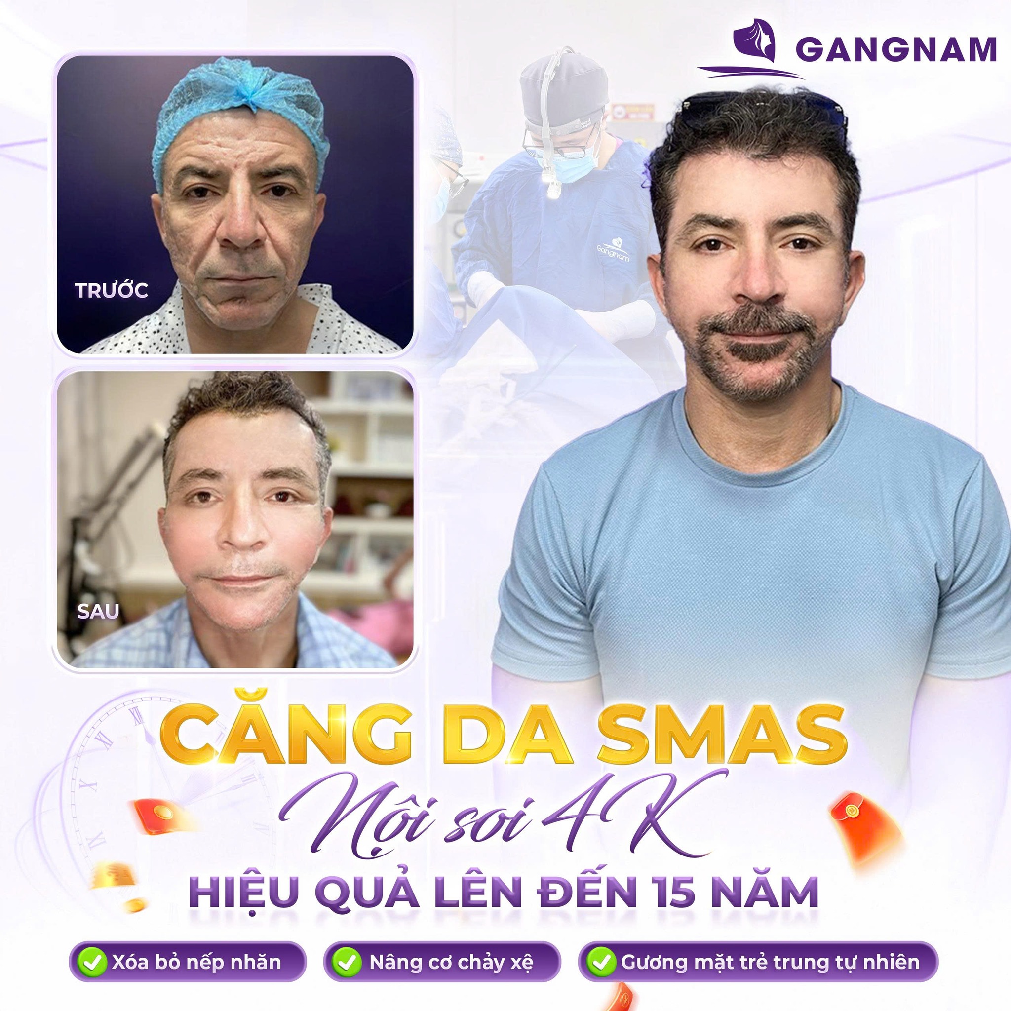 Căng Da Nội Soi SMAS: Bí Quyết Nâng Cơ Trẻ Hóa Tự Nhiên Không Lộ Dấu Vết 6 Căng da nội soi SMAS chuẩn y khoa tại Thẩm mỹ Gangnam