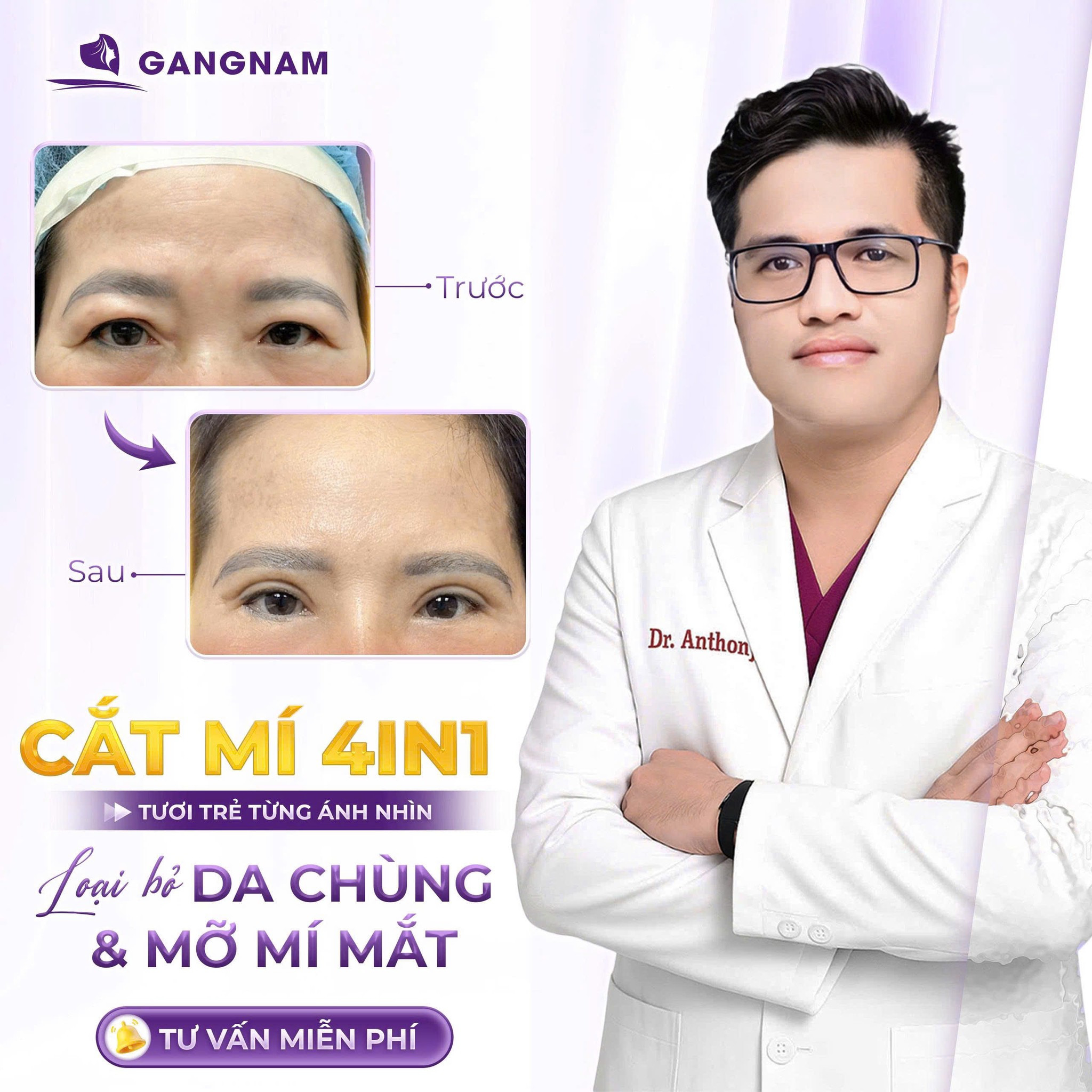 Cắt Mắt Eyelid Cùng Dr.Anthony Lê: Bí Quyết Sở Hữu Đôi Mắt To Tròn, Cuốn Hút 5 Lý do nên chọn cắt mắt Eyelid cùng Dr.Anthony Lê